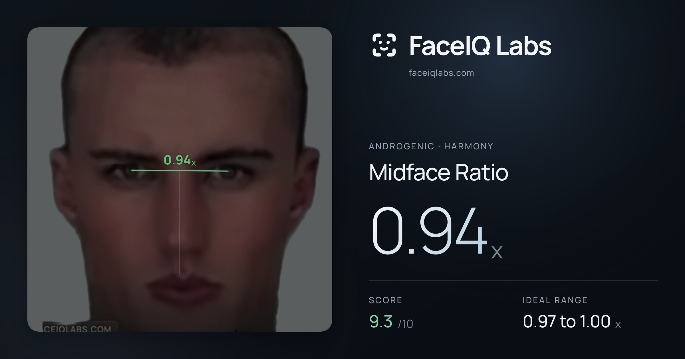 Androgenic Midface Ratio: 0.94x, drawn on the photo