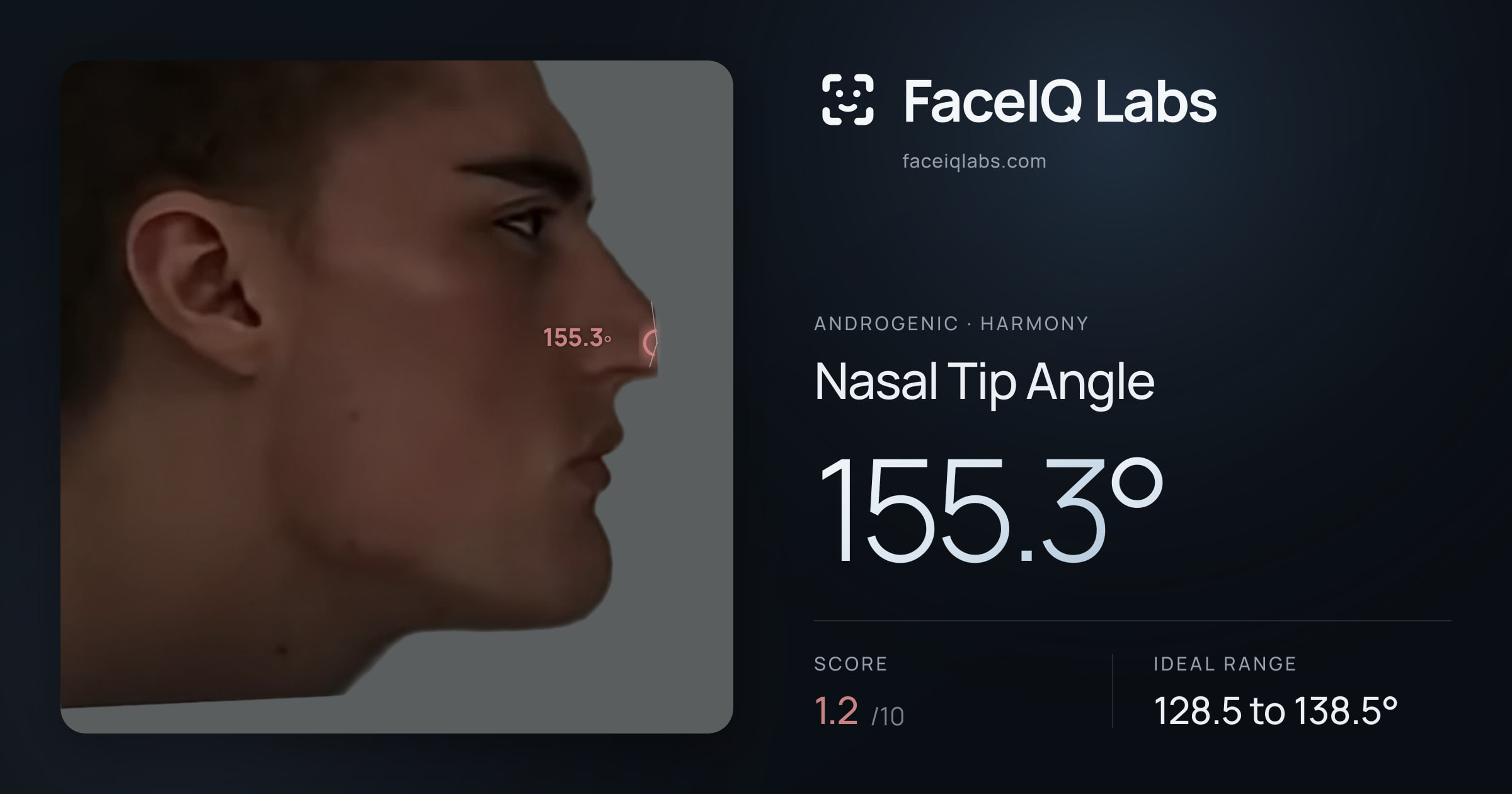 Androgenic Nasal Tip Angle: 145.5°, drawn on the photo