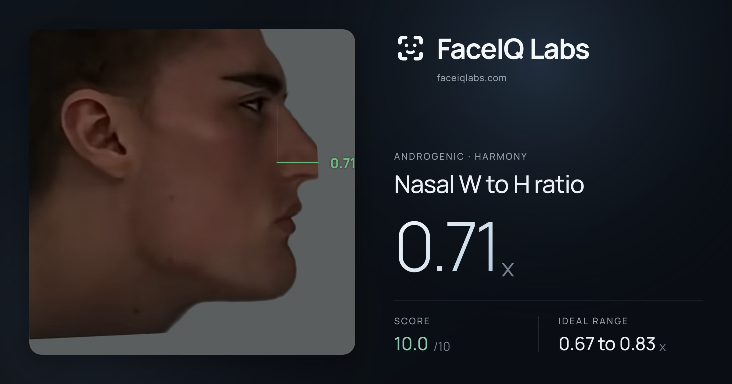 Androgenic Nasal W to H ratio: 0.71x, drawn on the photo