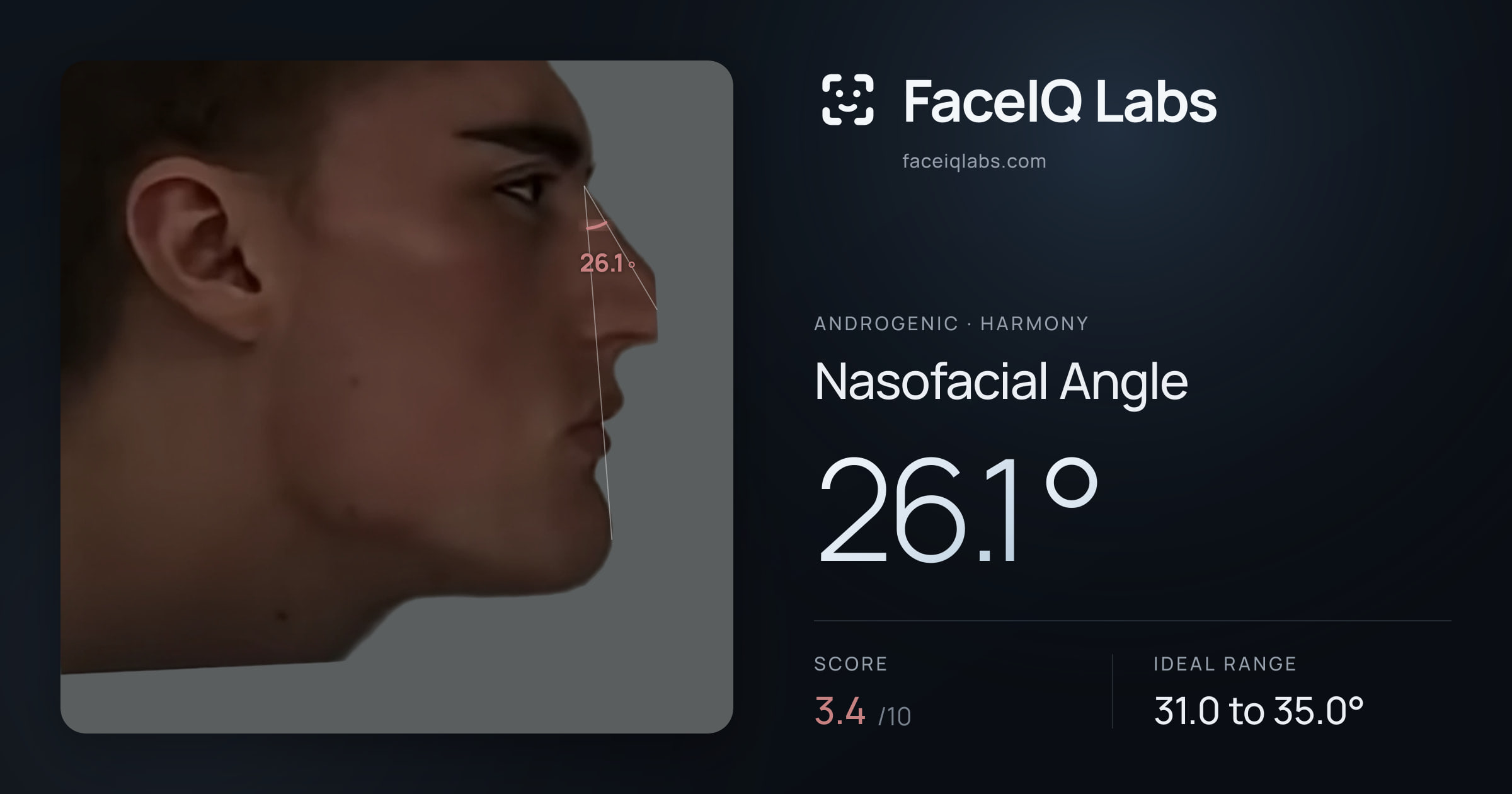 Androgenic Nasofacial Angle: 26.1°, drawn on the photo