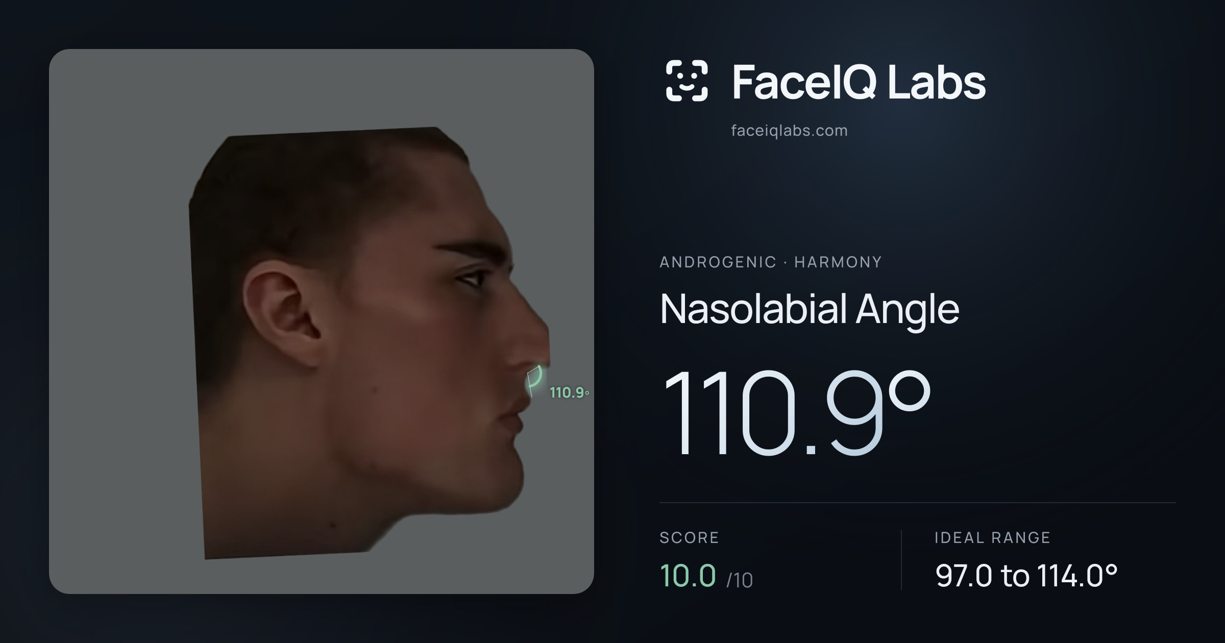 Androgenic Nasolabial Angle: 110.9°, drawn on the photo