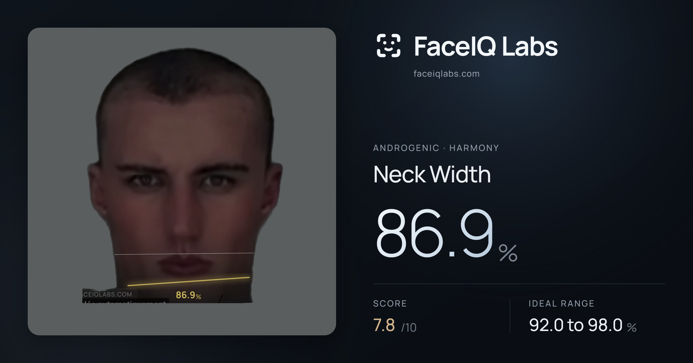 Androgenic Neck Width: 86.9%, drawn on the photo
