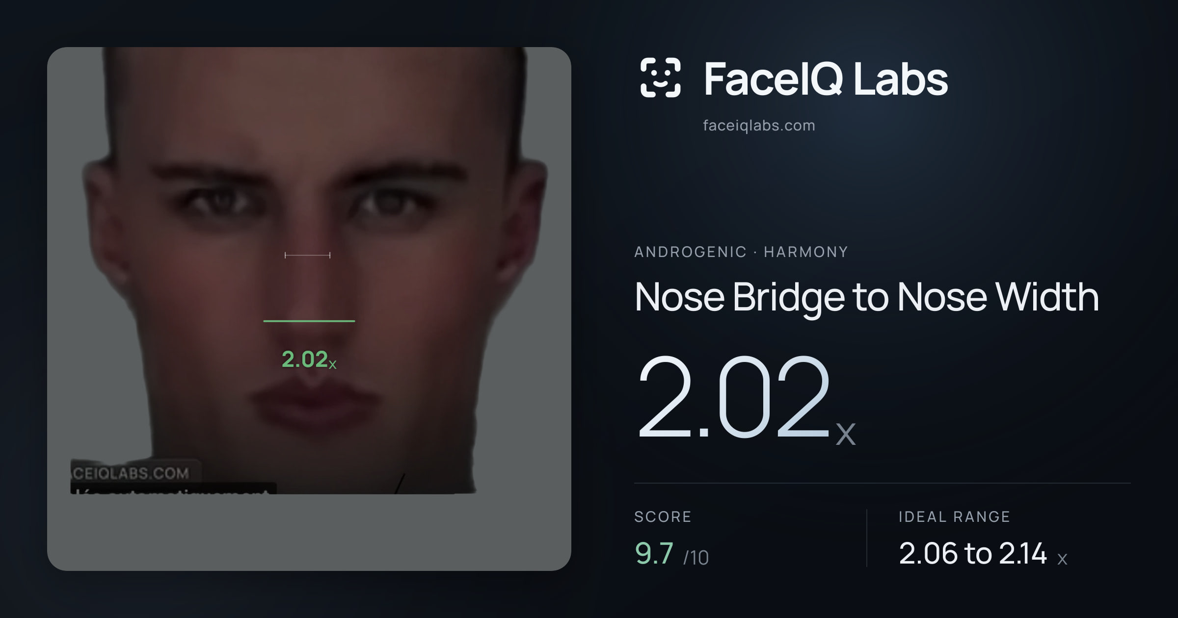 Androgenic Nose Bridge to Nose Width: 2.02x, drawn on the photo