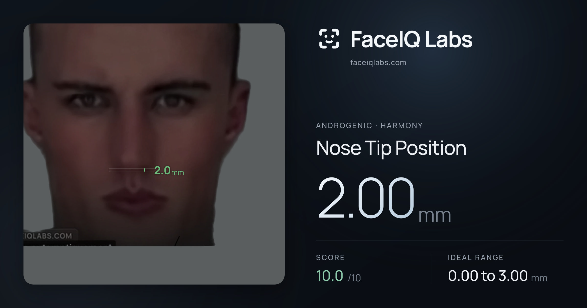 Androgenic Nose Tip Position: 2.00mm, drawn on the photo