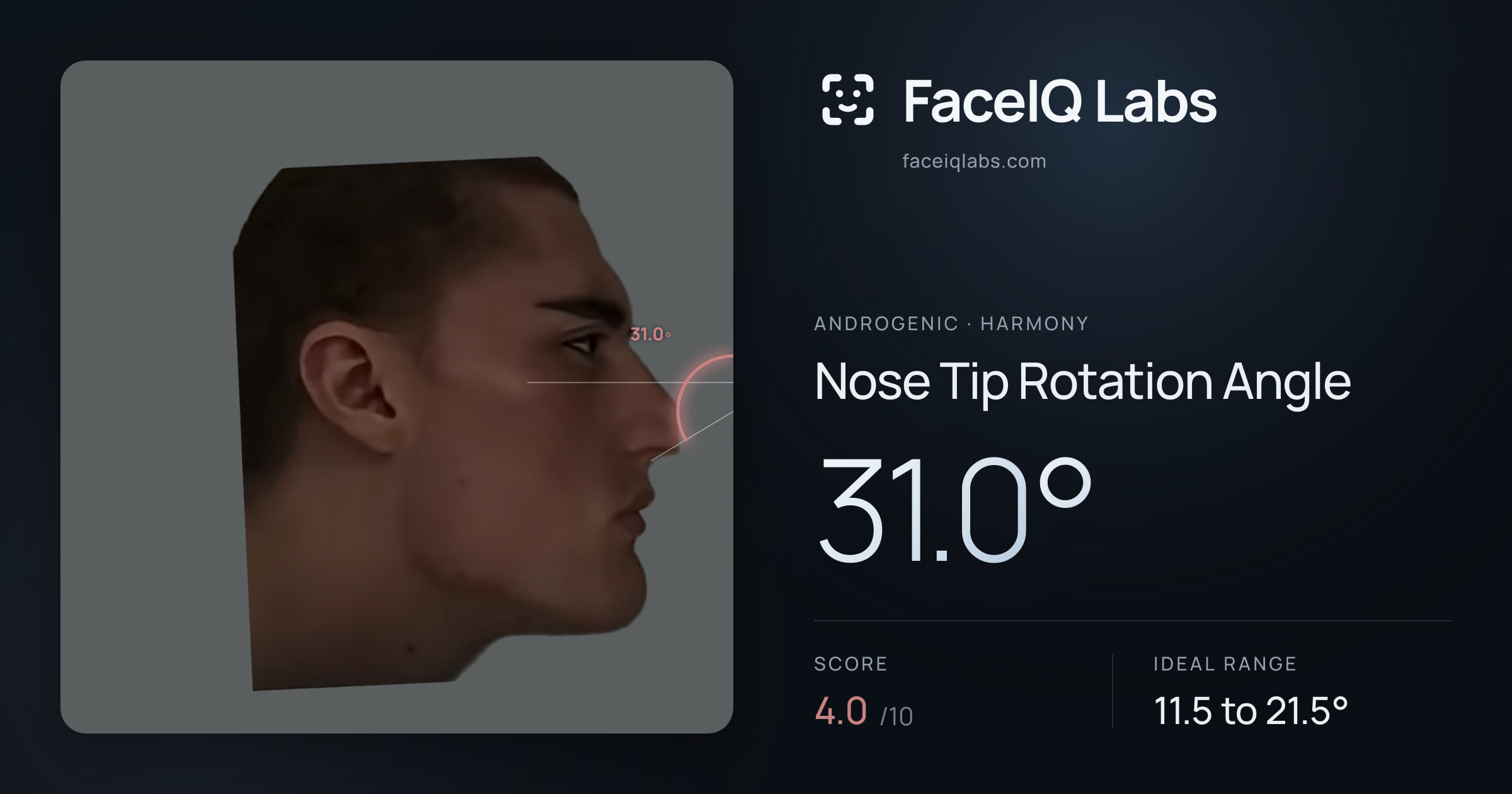 Androgenic Nose Tip Rotation Angle: 31.0°, drawn on the photo