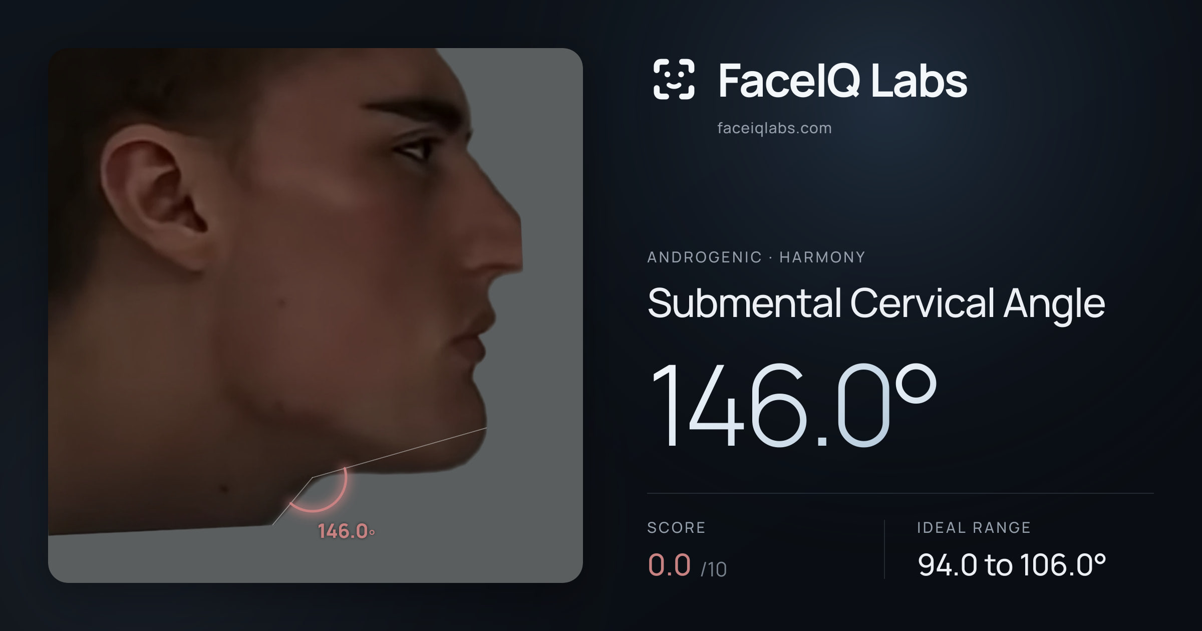Androgenic Submental Cervical Angle: 134.0°, drawn on the photo