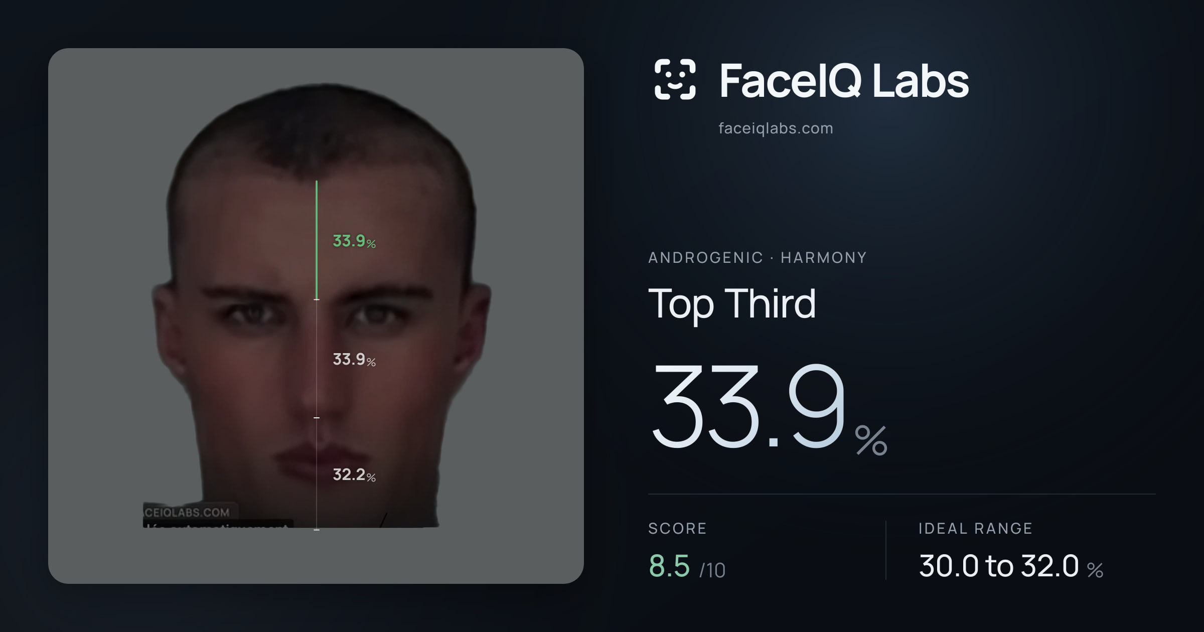 Androgenic Top Third: 33.9%, drawn on the photo