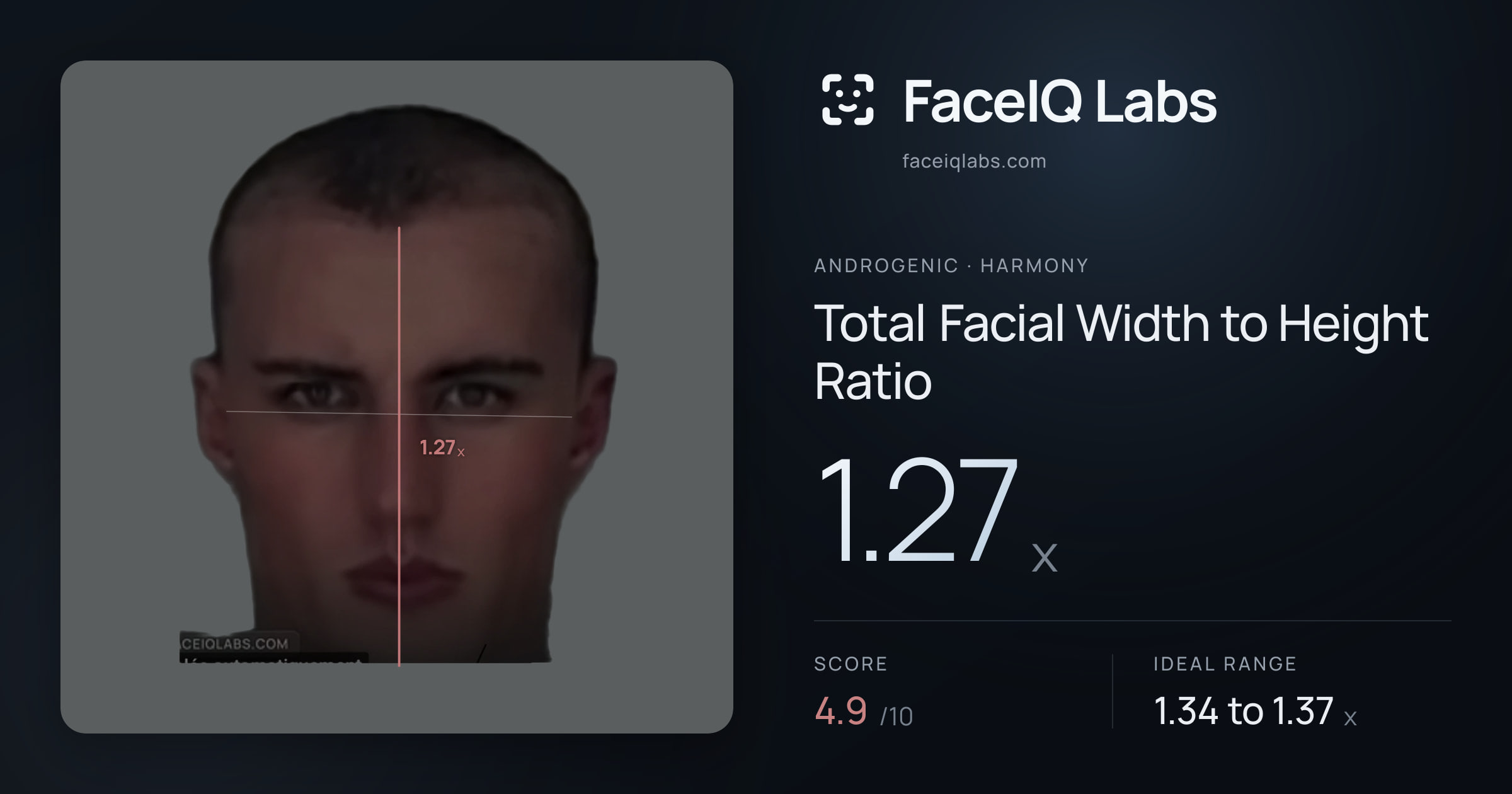 Androgenic Total Facial Width to Height Ratio: 1.27x, drawn on the photo