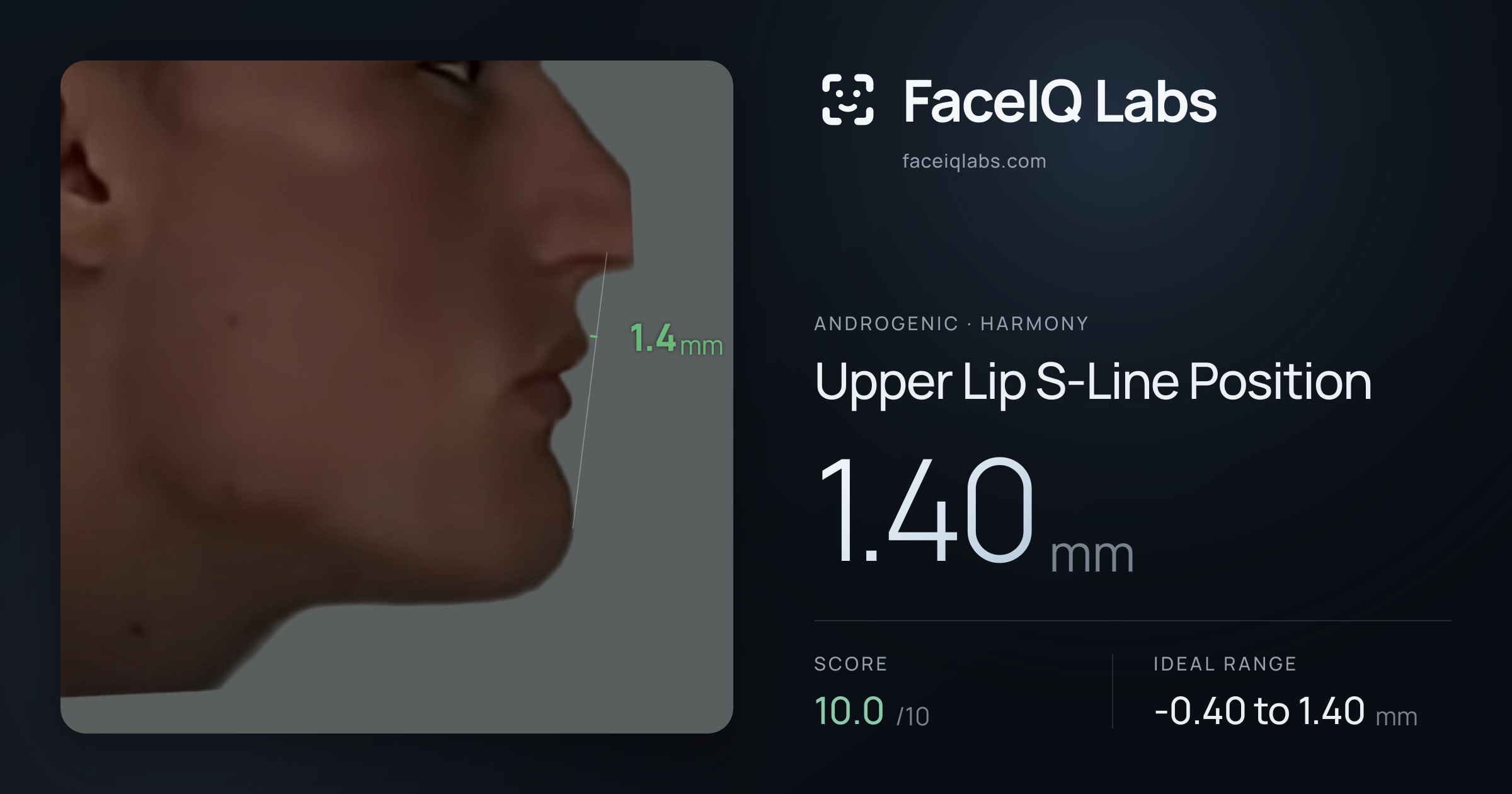 Androgenic Upper Lip S-Line Position: 1.40mm, drawn on the photo