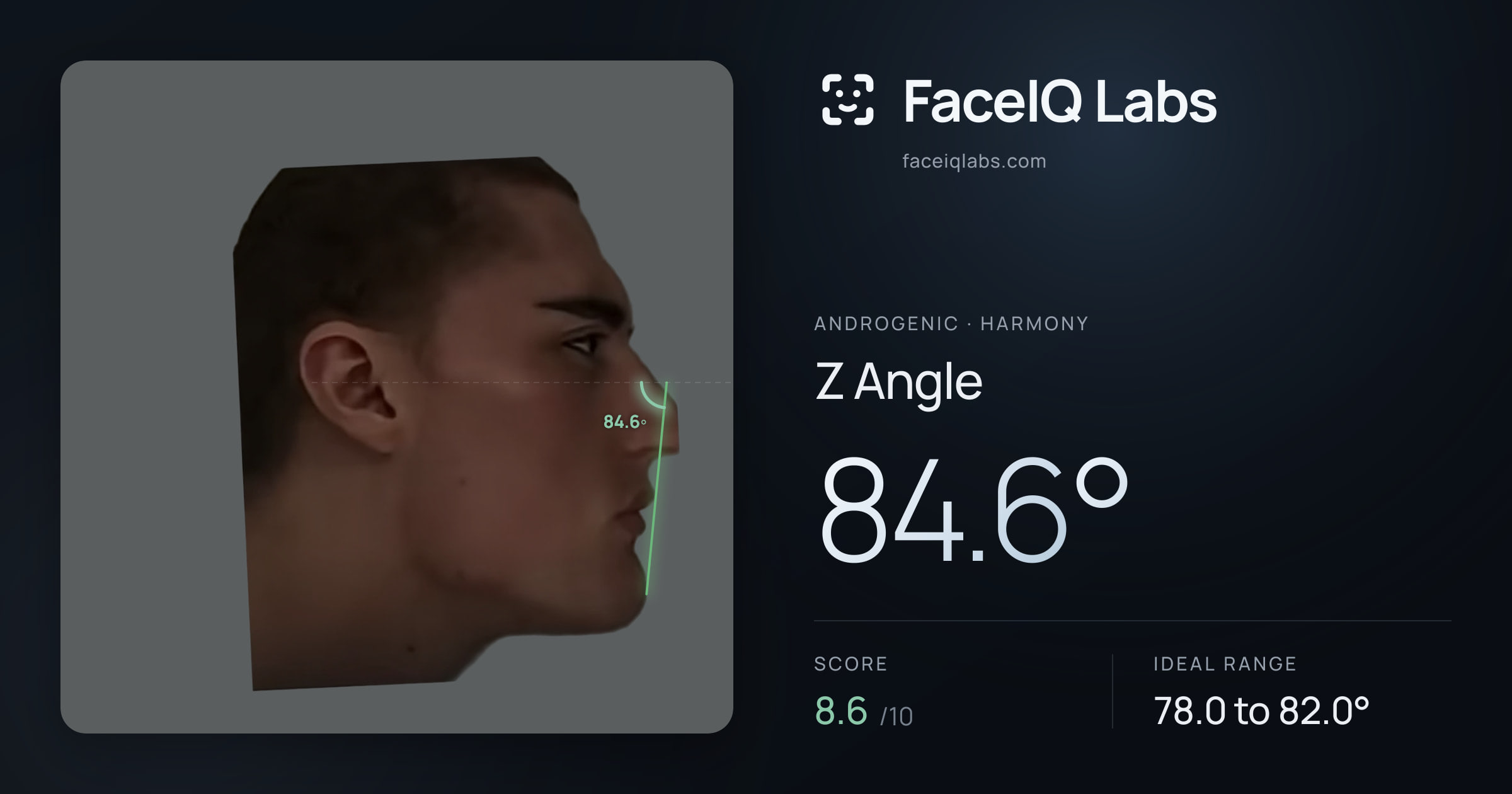 Androgenic Z Angle: 84.6°, drawn on the photo