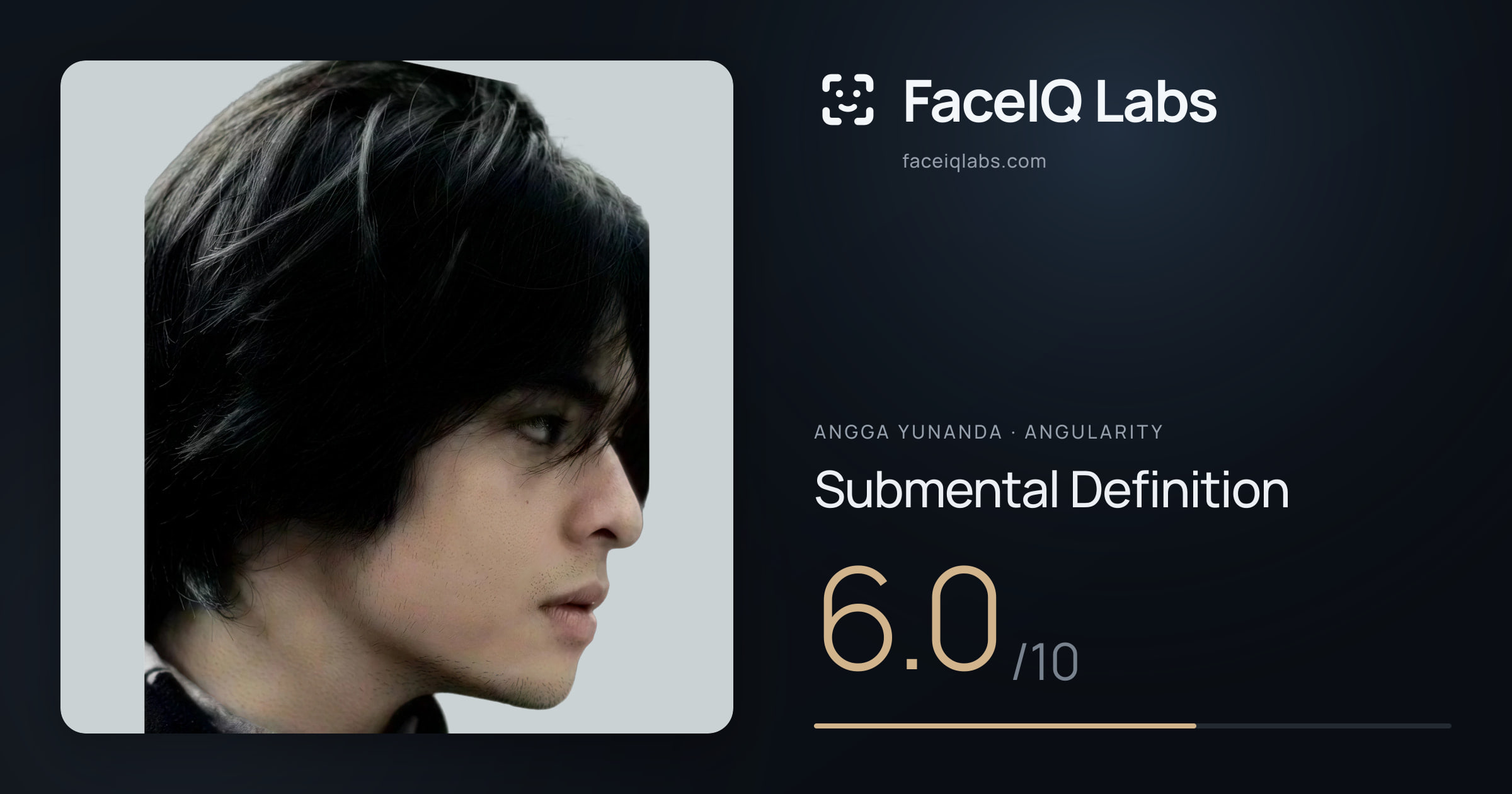 Angga Yunanda Submental Definition: 6.0/10, drawn on the photo