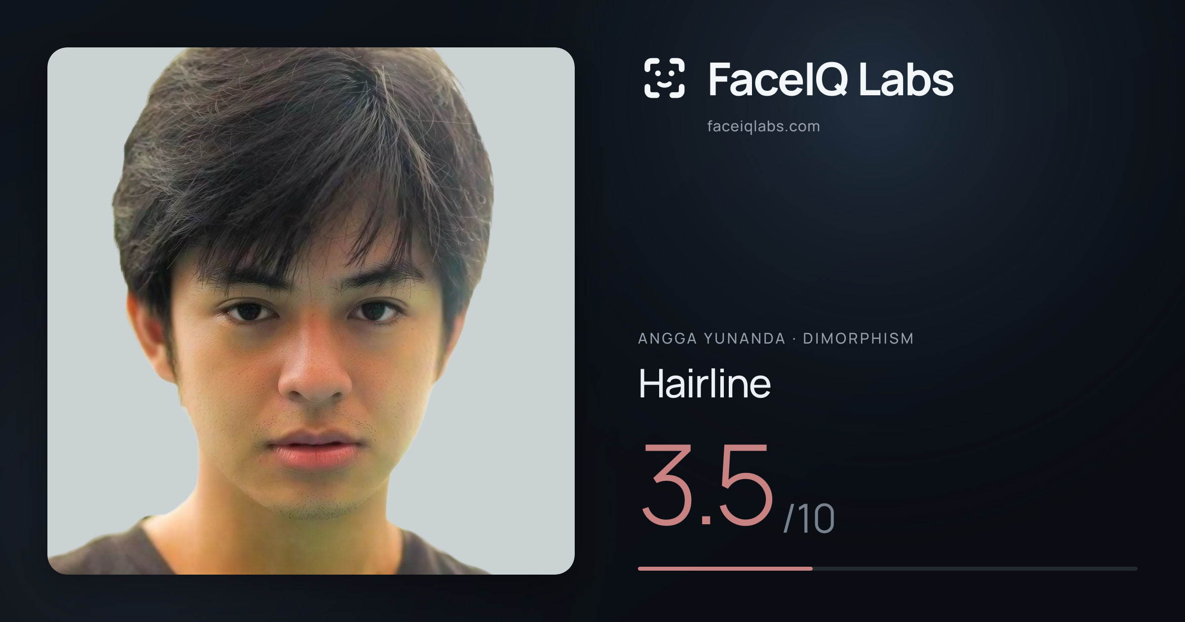 Angga Yunanda Hairline: 3.5/10, drawn on the photo