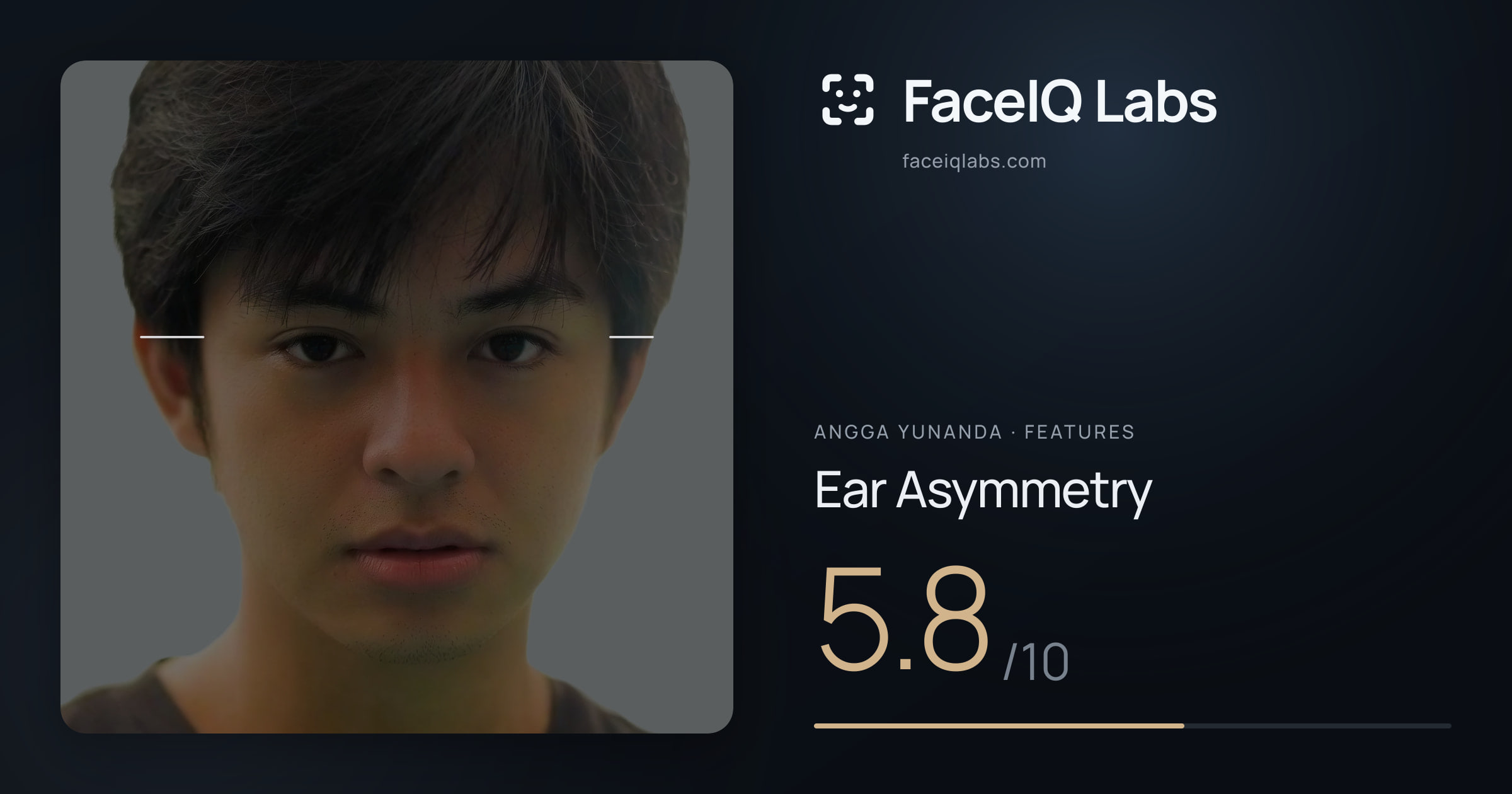 Angga Yunanda Ear Asymmetry: 5.8/10, drawn on the photo