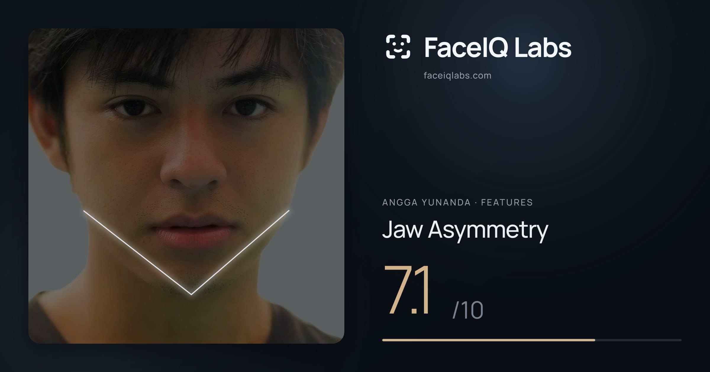 Angga Yunanda Jaw Asymmetry: 7.1/10, drawn on the photo