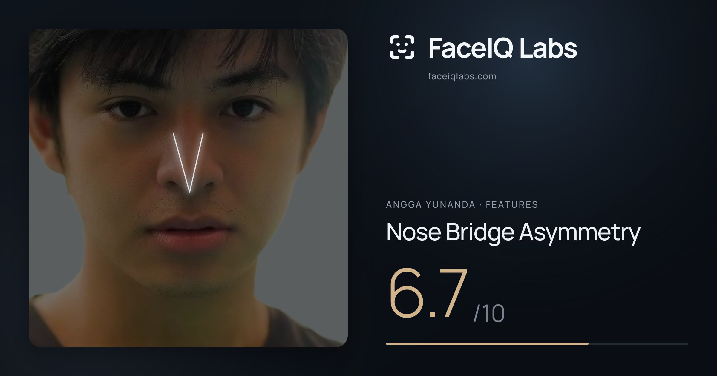Angga Yunanda Nose Bridge Asymmetry: 6.7/10, drawn on the photo