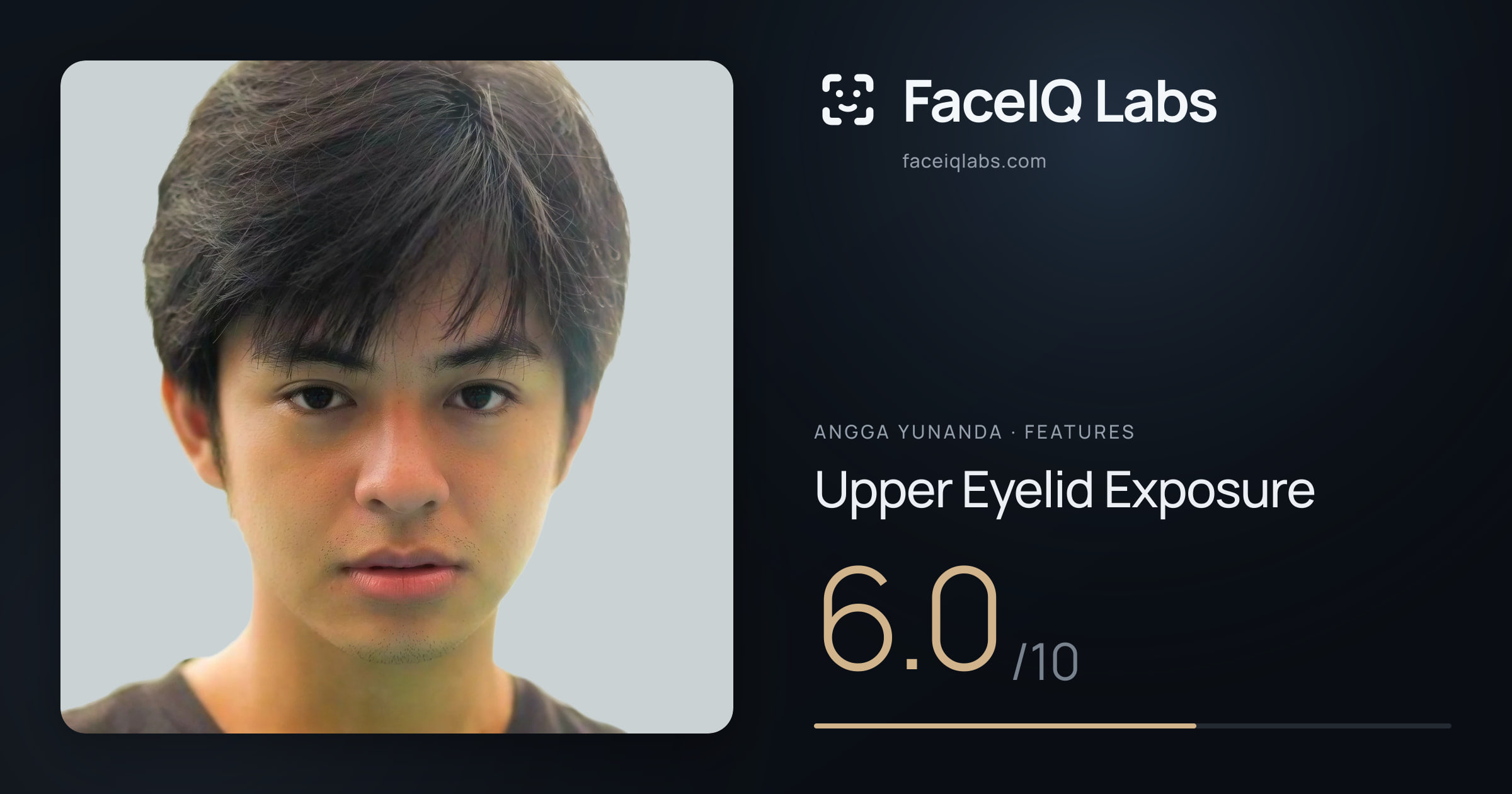 Angga Yunanda Upper Eyelid Exposure: 6.0/10, drawn on the photo