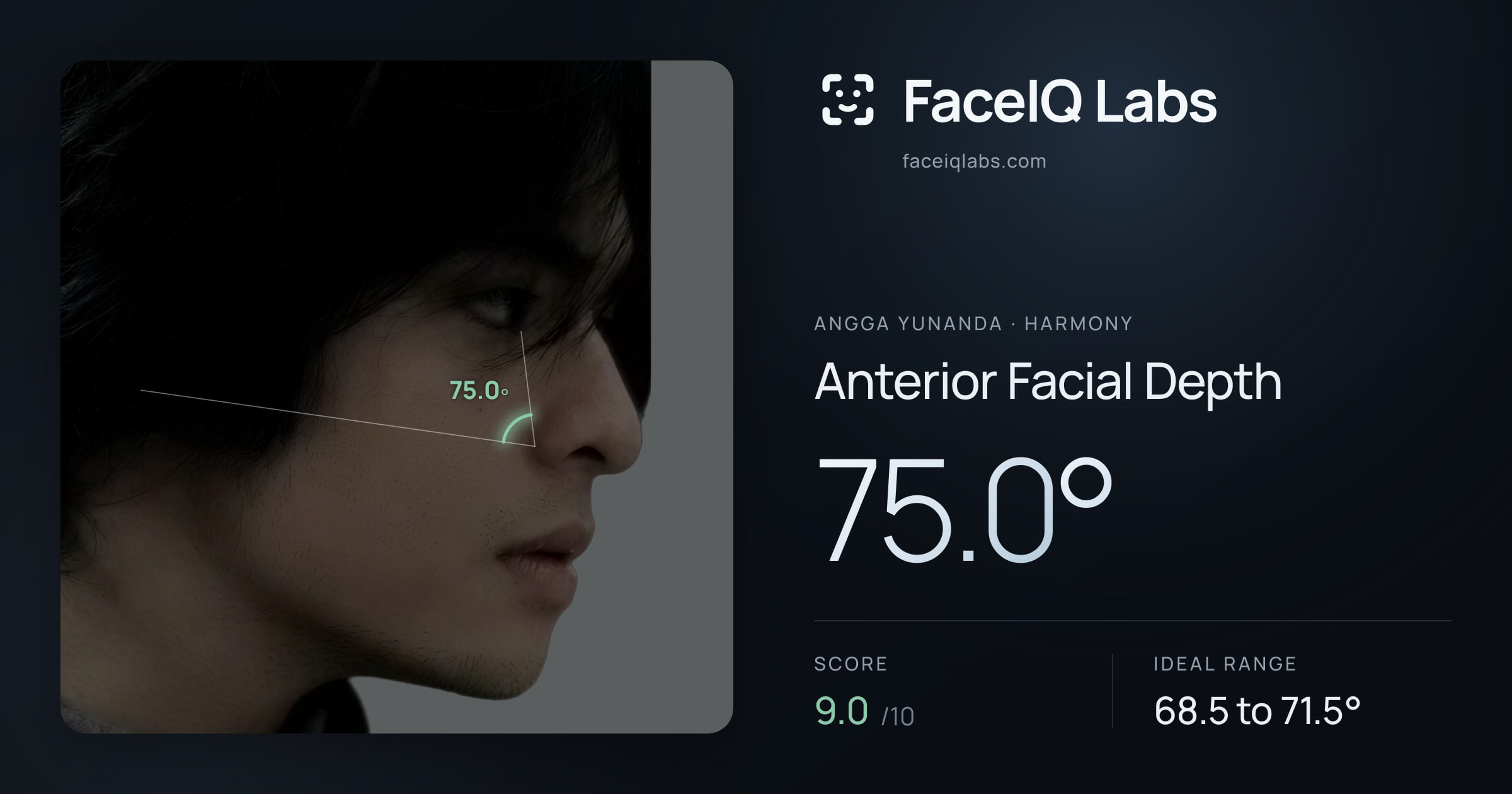 Angga Yunanda Anterior Facial Depth: 75.0°, drawn on the photo