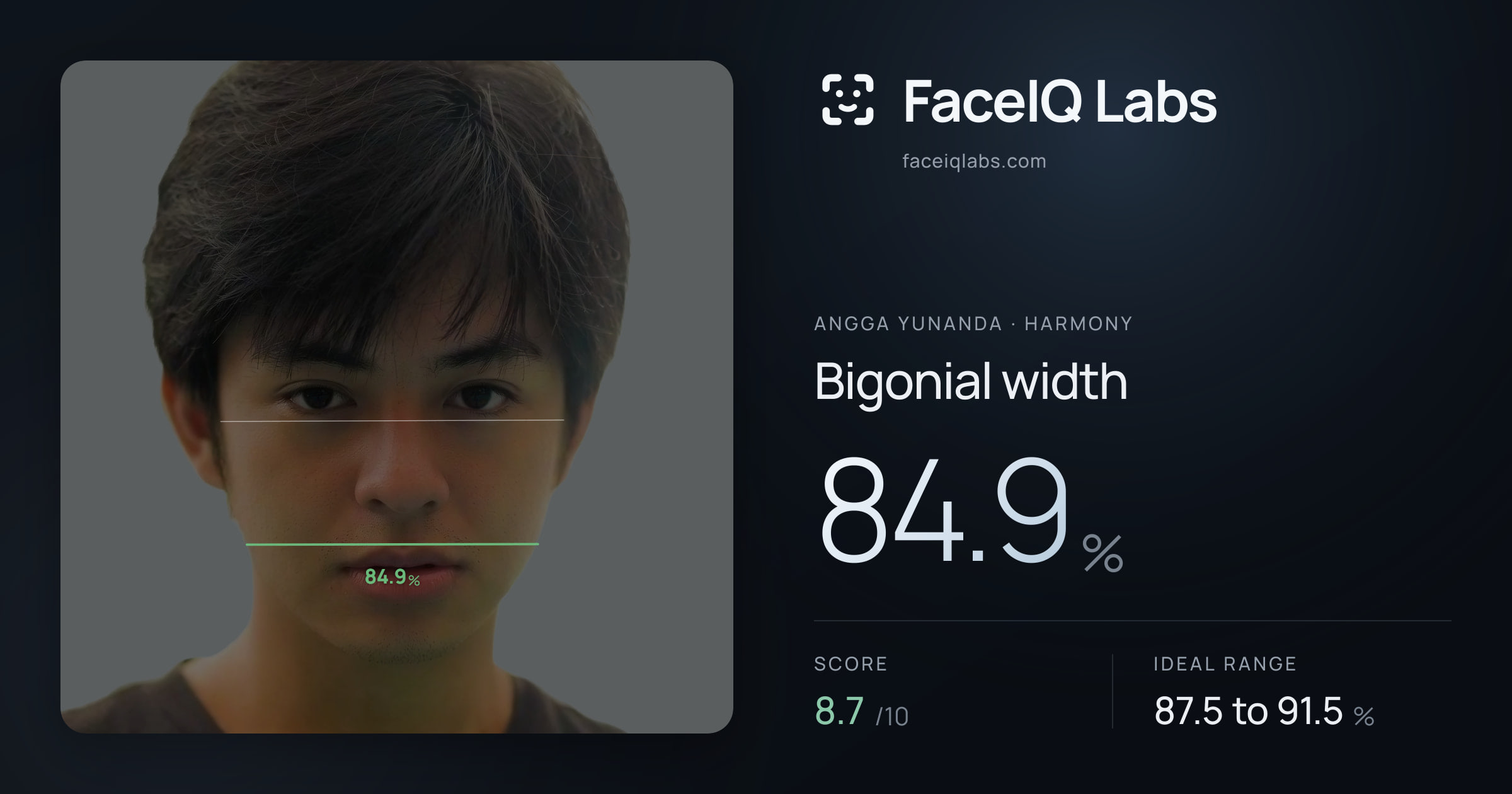 Angga Yunanda Bigonial width: 84.9%, drawn on the photo
