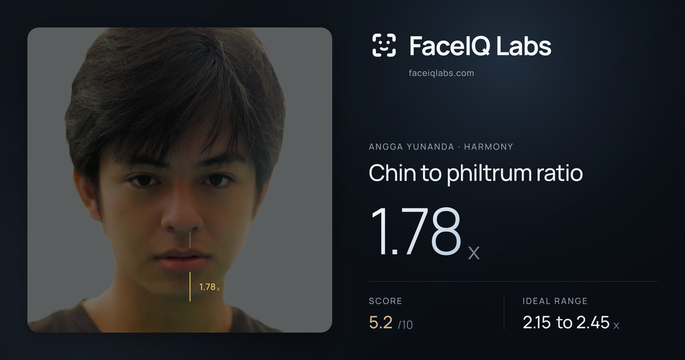Angga Yunanda Chin to philtrum ratio: 1.78x, drawn on the photo