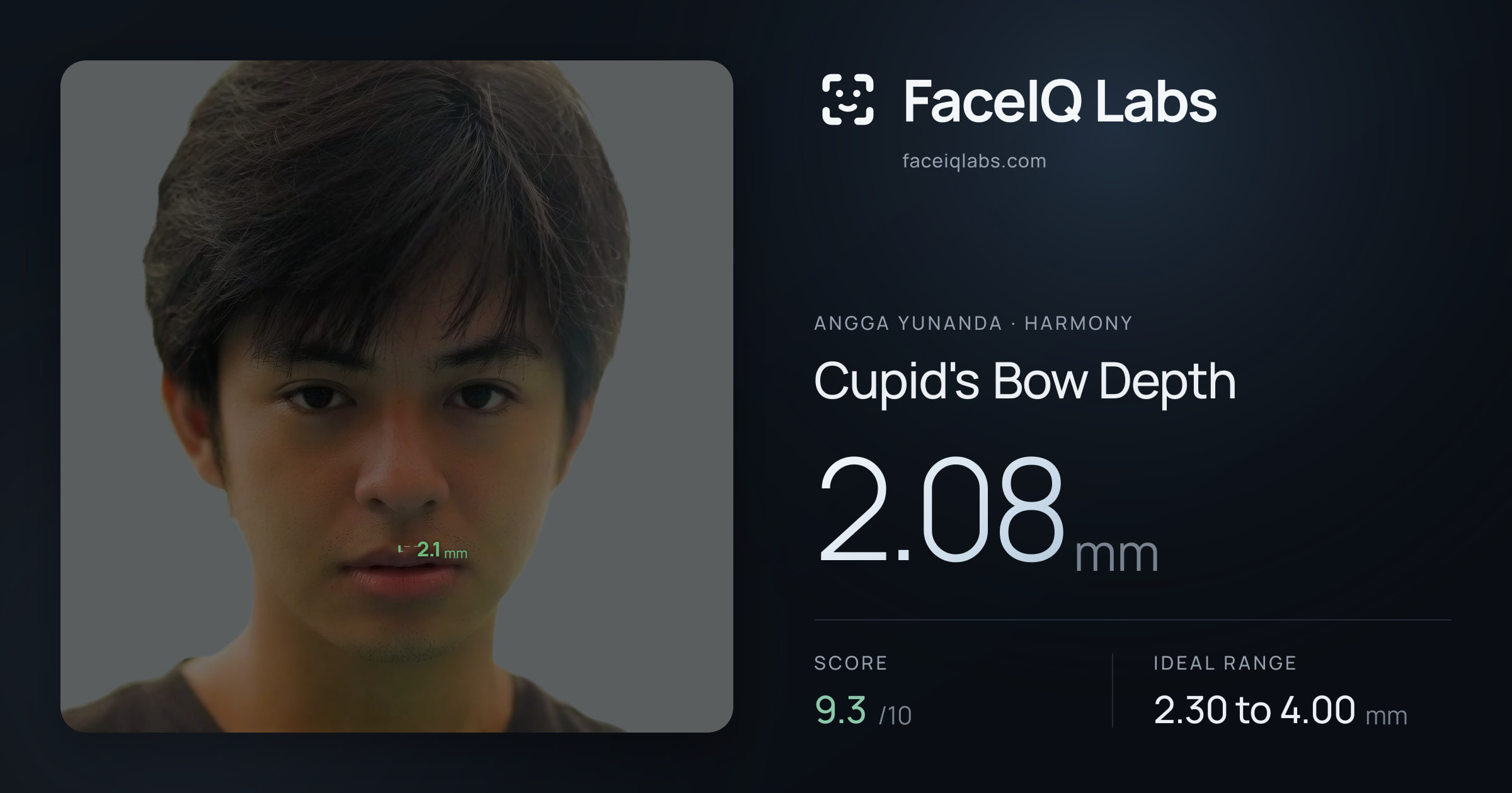 Angga Yunanda Cupid's Bow Depth: 2.08mm, drawn on the photo