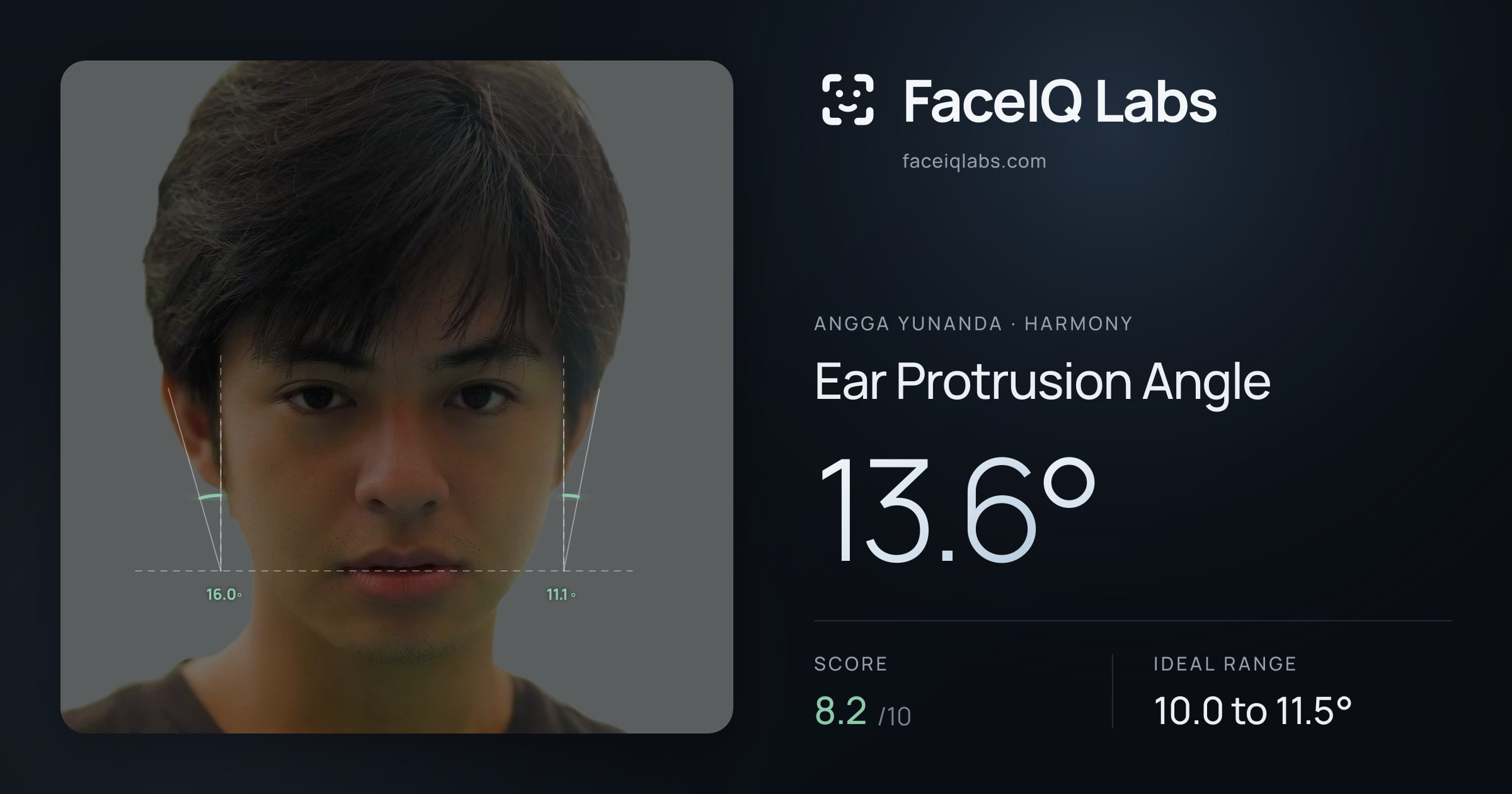 Angga Yunanda Ear Protrusion Angle: 13.6°, drawn on the photo