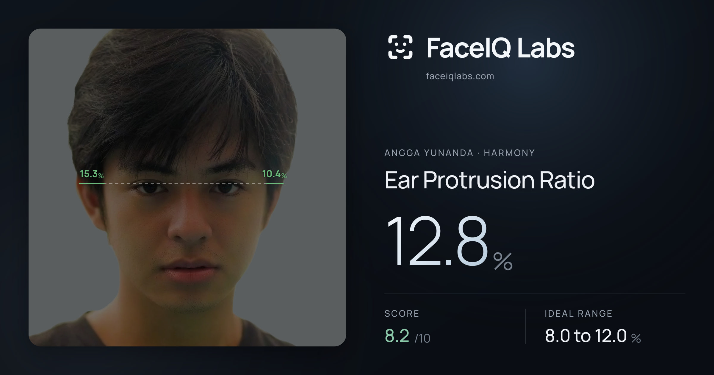 Angga Yunanda Ear Protrusion Ratio: 12.8%, drawn on the photo