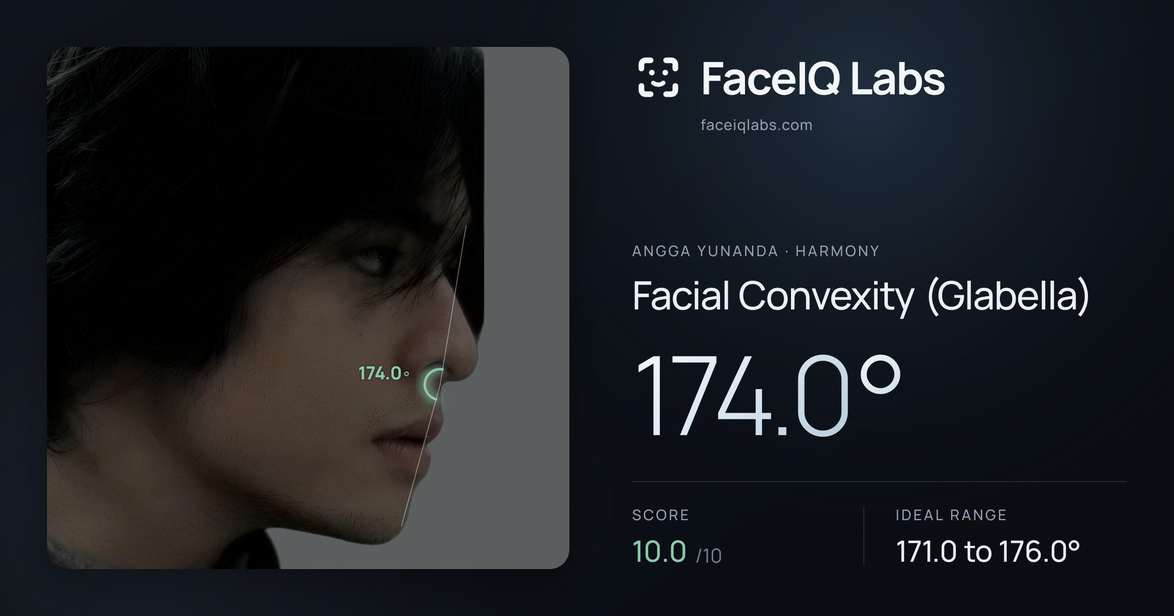 Angga Yunanda Facial Convexity (Glabella): 174.0°, drawn on the photo