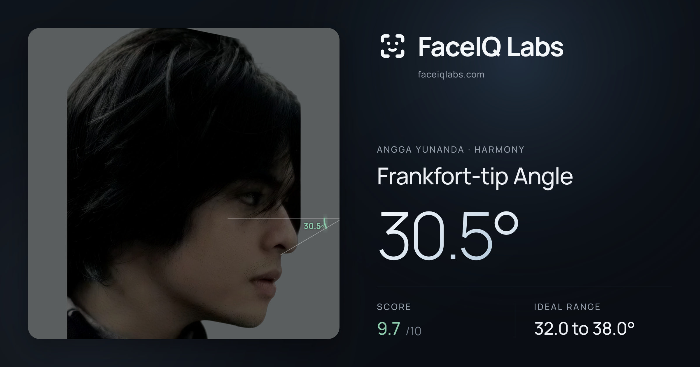 Angga Yunanda Frankfort-tip Angle: 30.5°, drawn on the photo