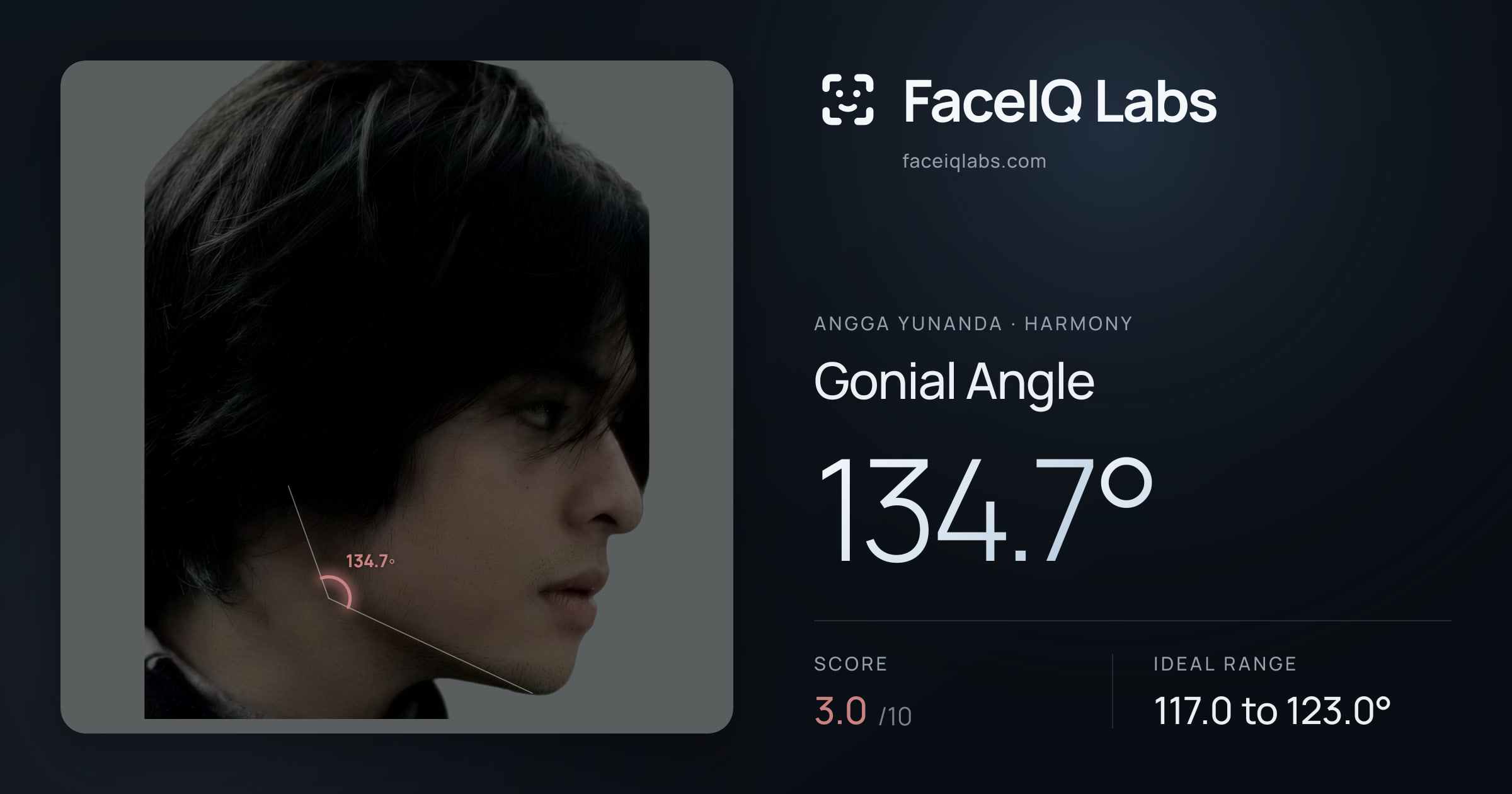 Angga Yunanda Gonial Angle: 134.7°, drawn on the photo