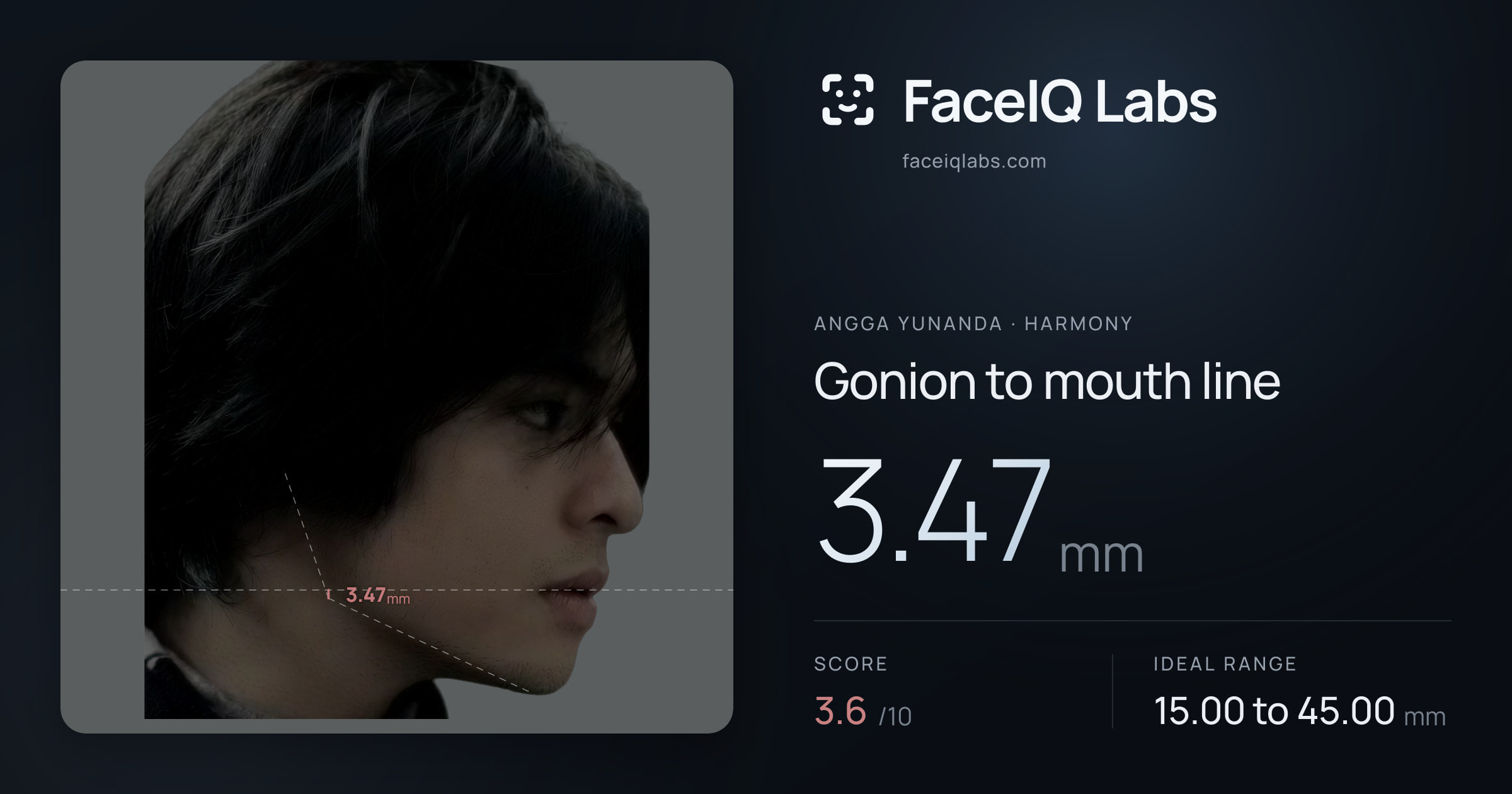 Angga Yunanda Gonion to mouth line: 3.47mm, drawn on the photo