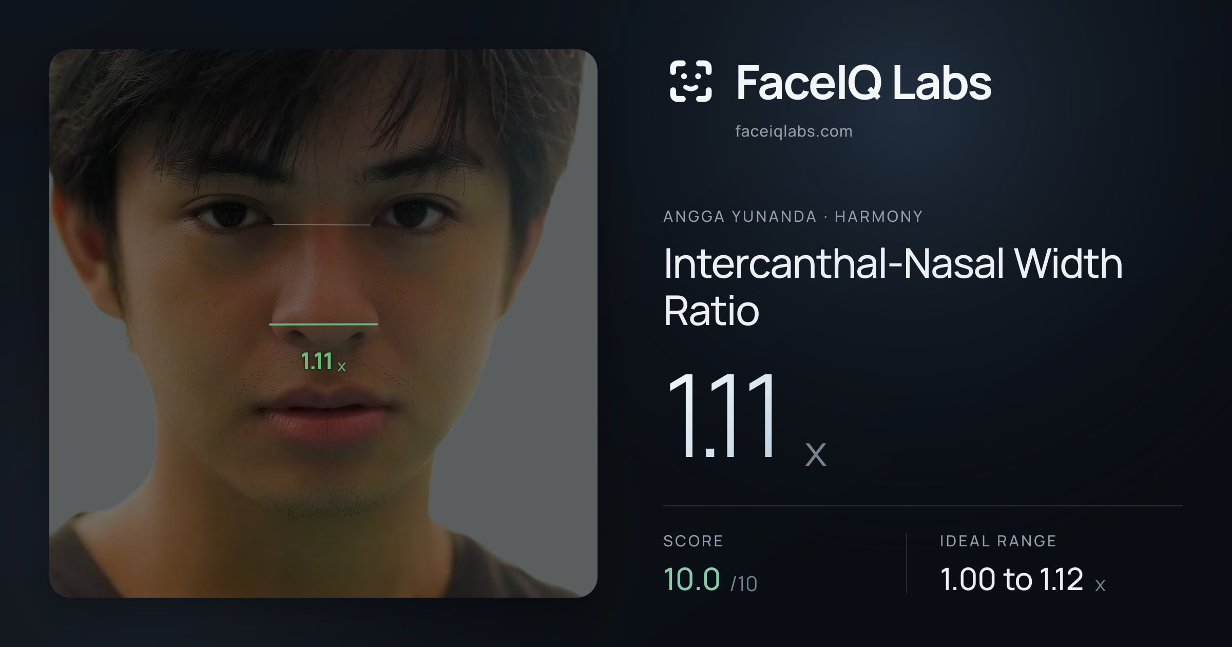 Angga Yunanda Intercanthal-Nasal Width Ratio: 1.11x, drawn on the photo