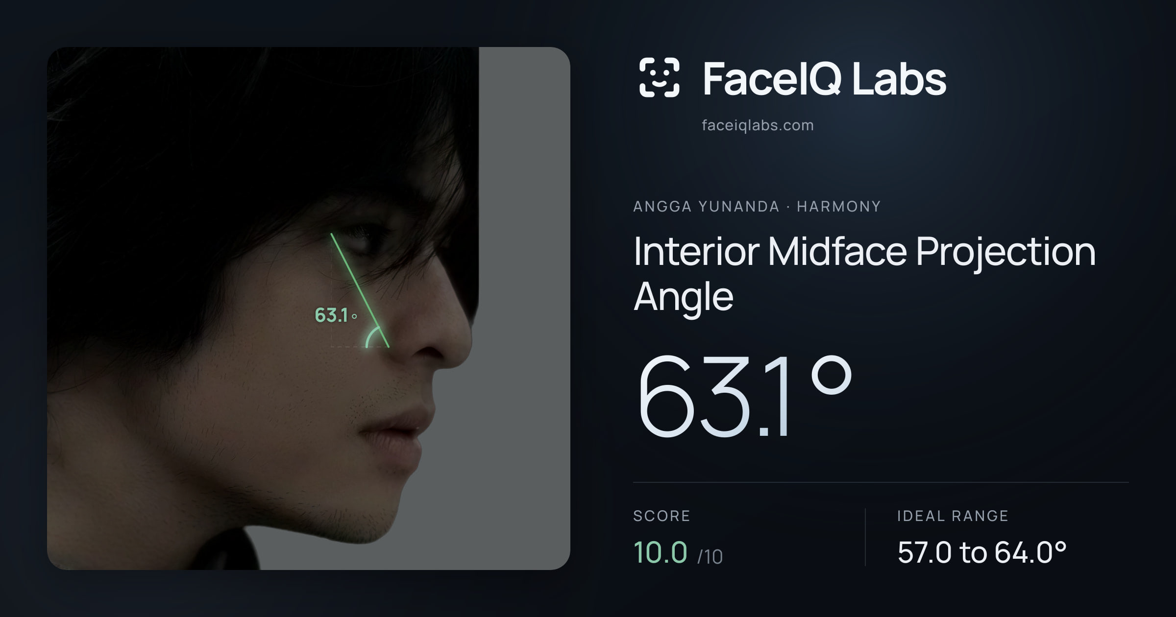 Angga Yunanda Interior Midface Projection Angle: 63.1°, drawn on the photo