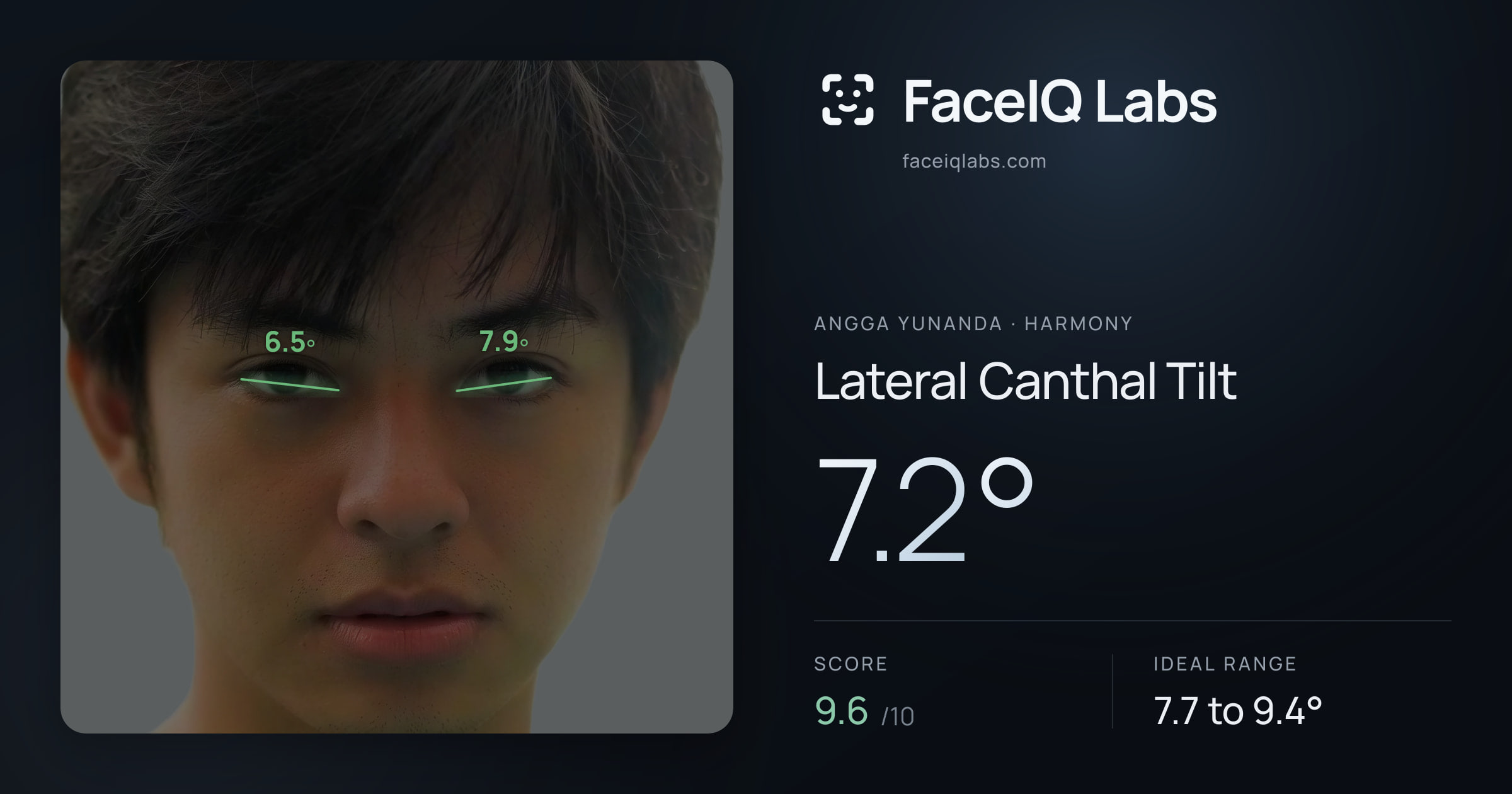 Angga Yunanda Lateral Canthal Tilt: 7.2°, drawn on the photo