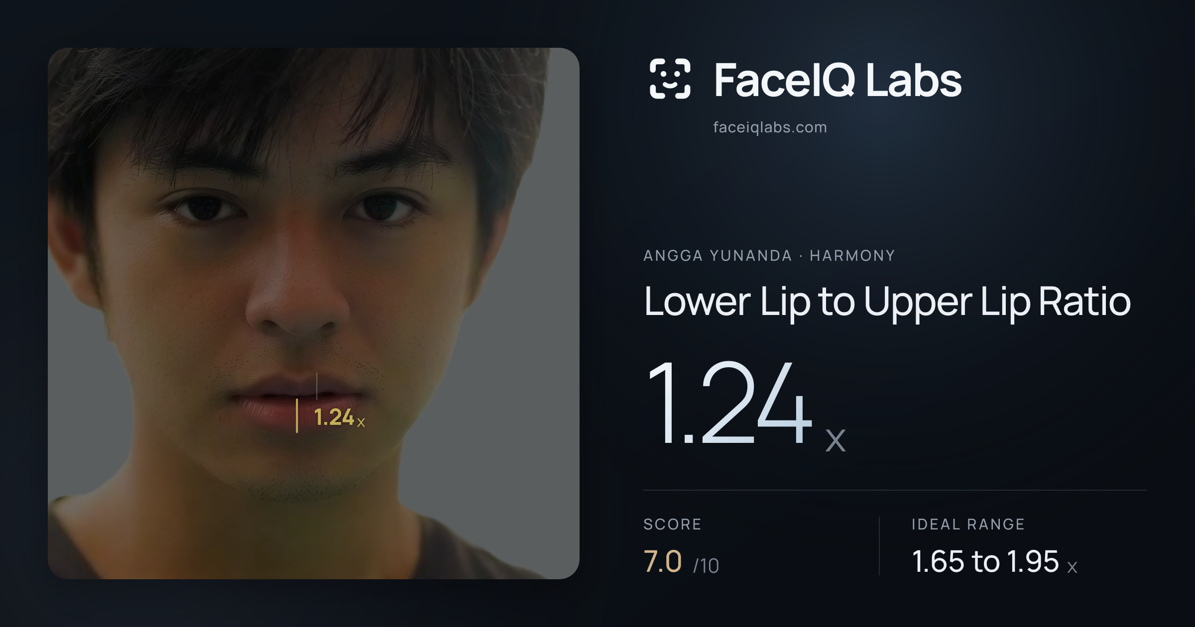 Angga Yunanda Lower Lip to Upper Lip Ratio: 1.24x, drawn on the photo