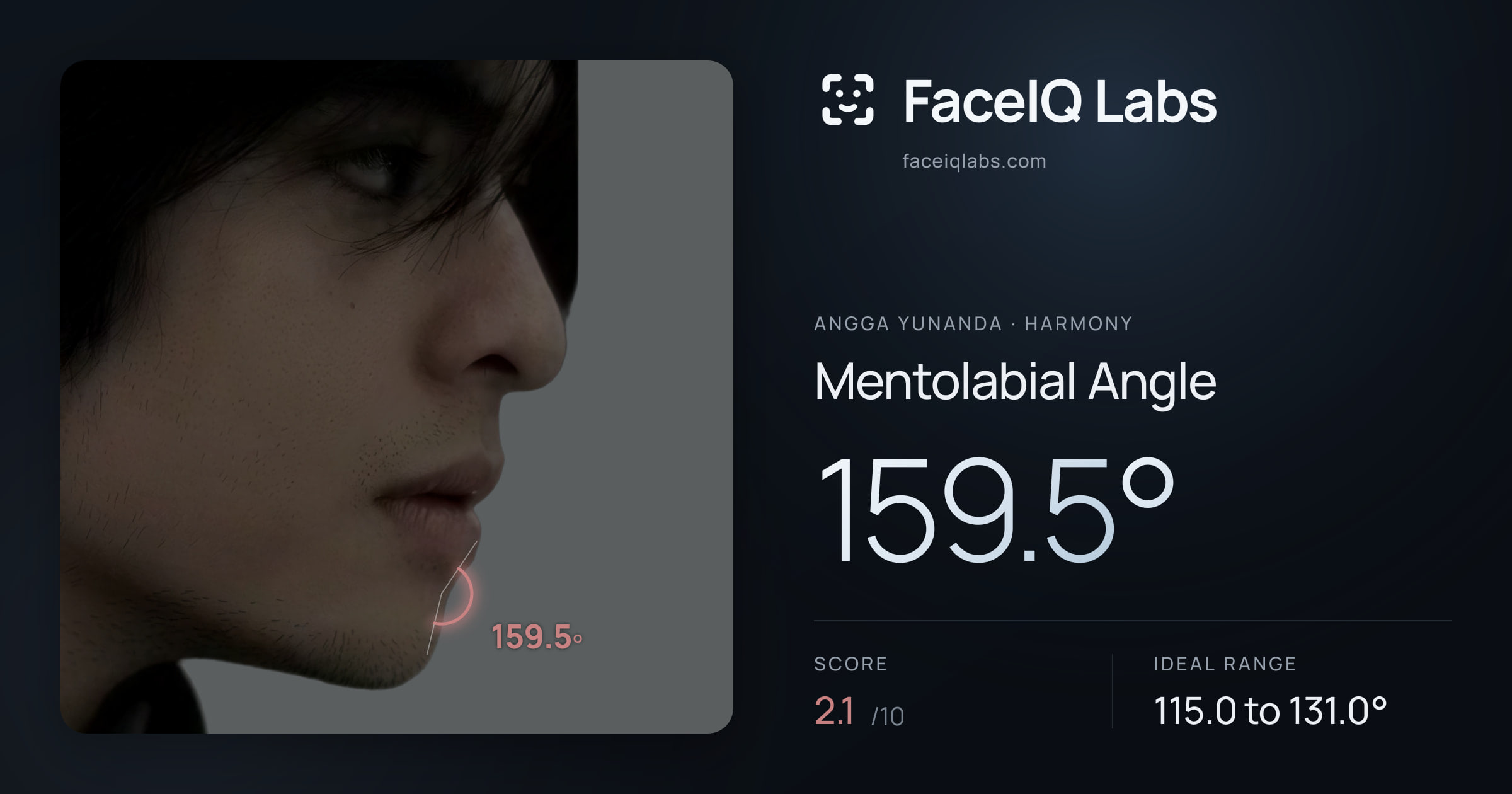 Angga Yunanda Mentolabial Angle: 159.5°, drawn on the photo