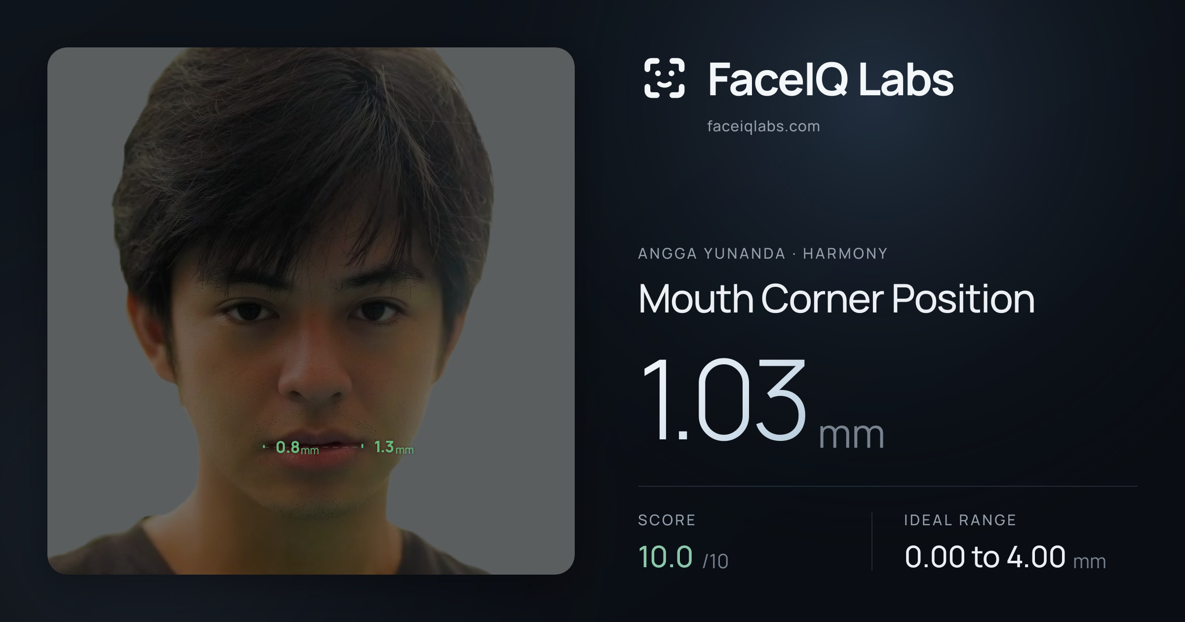 Angga Yunanda Mouth Corner Position: 1.03mm, drawn on the photo
