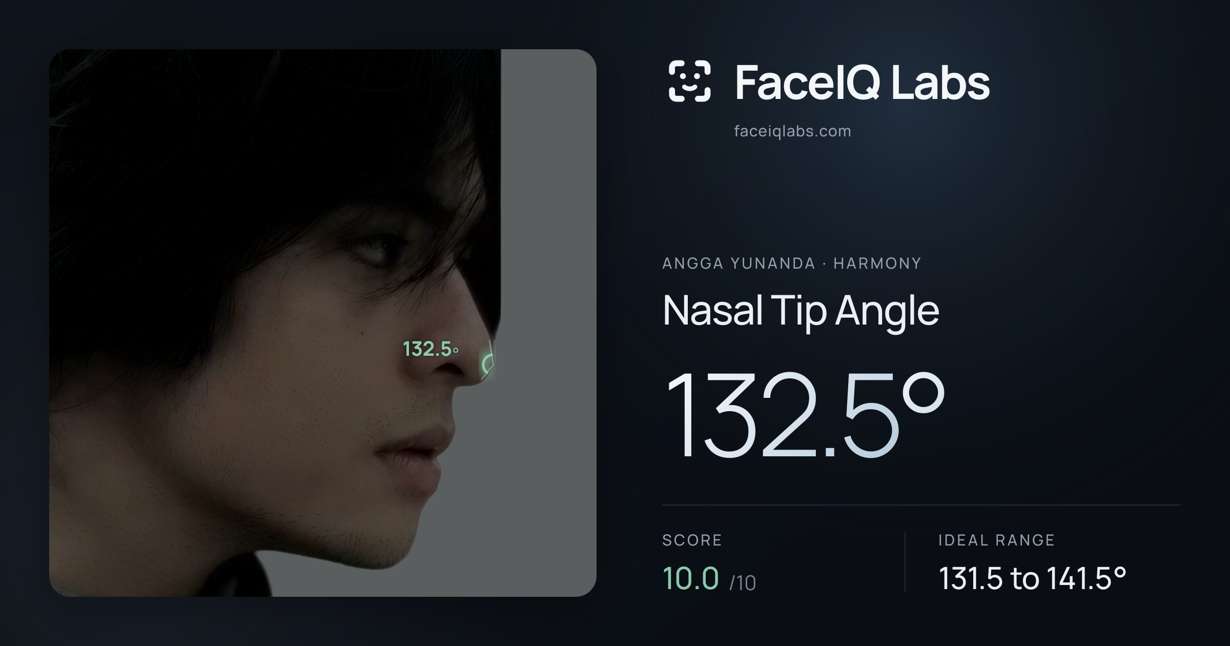 Angga Yunanda Nasal Tip Angle: 132.5°, drawn on the photo