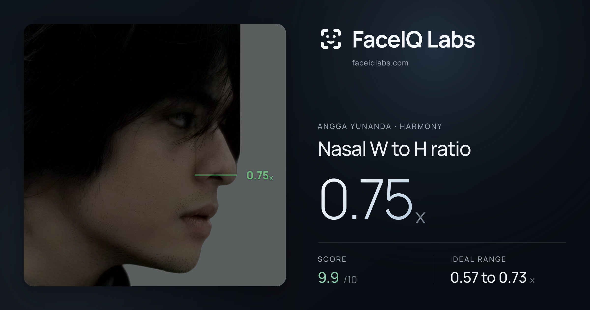 Angga Yunanda Nasal W to H ratio: 0.75x, drawn on the photo