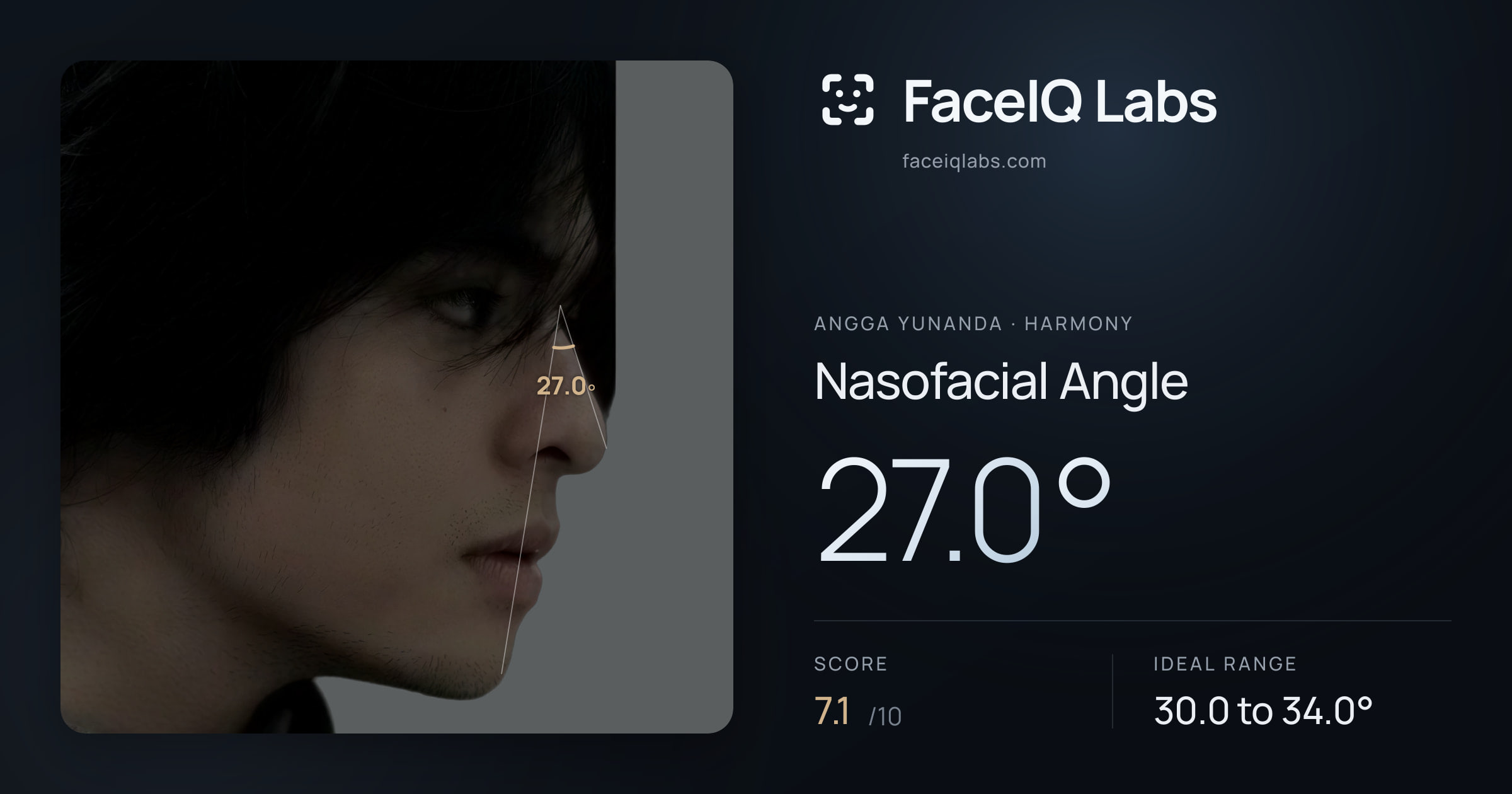Angga Yunanda Nasofacial Angle: 27.0°, drawn on the photo