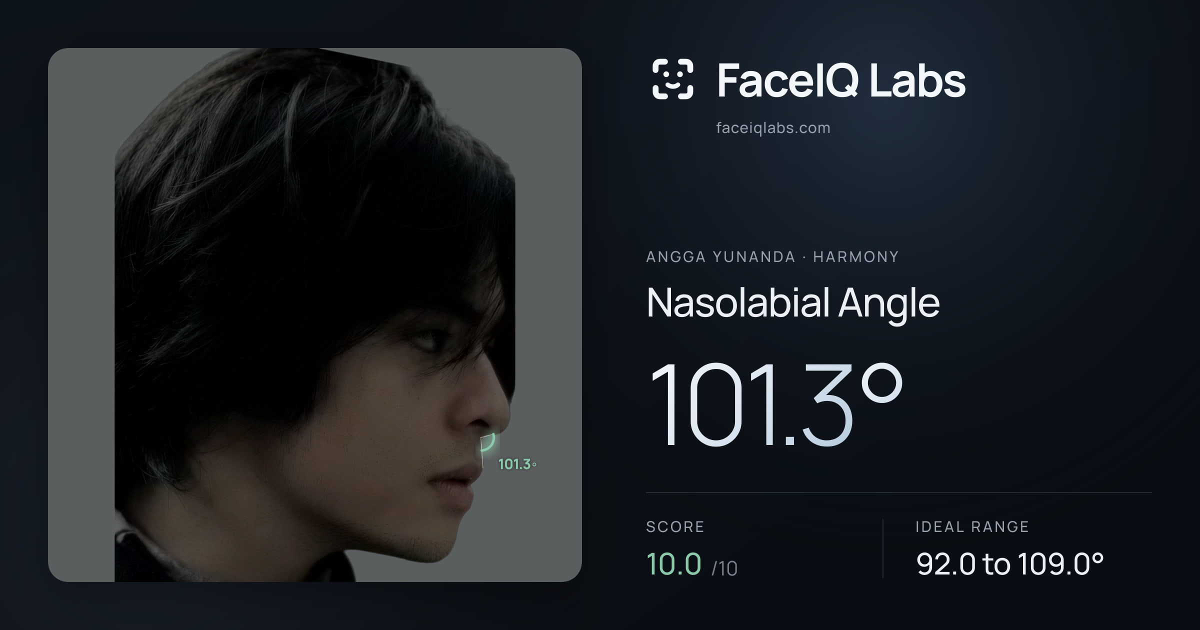 Angga Yunanda Nasolabial Angle: 101.3°, drawn on the photo