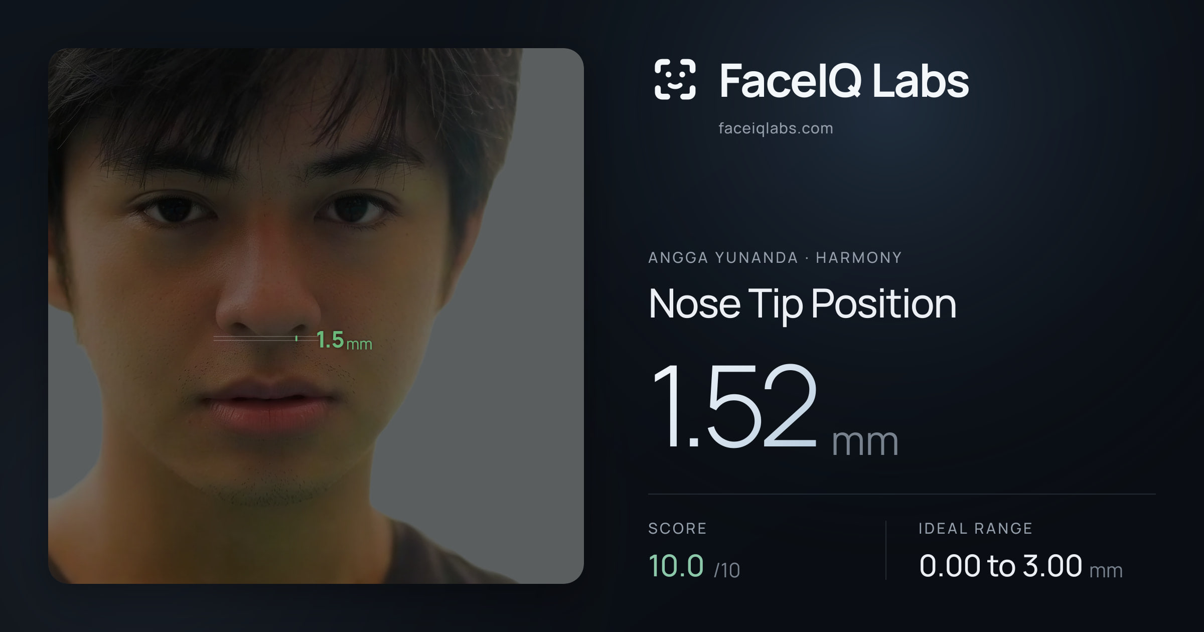 Angga Yunanda Nose Tip Position: 1.52mm, drawn on the photo