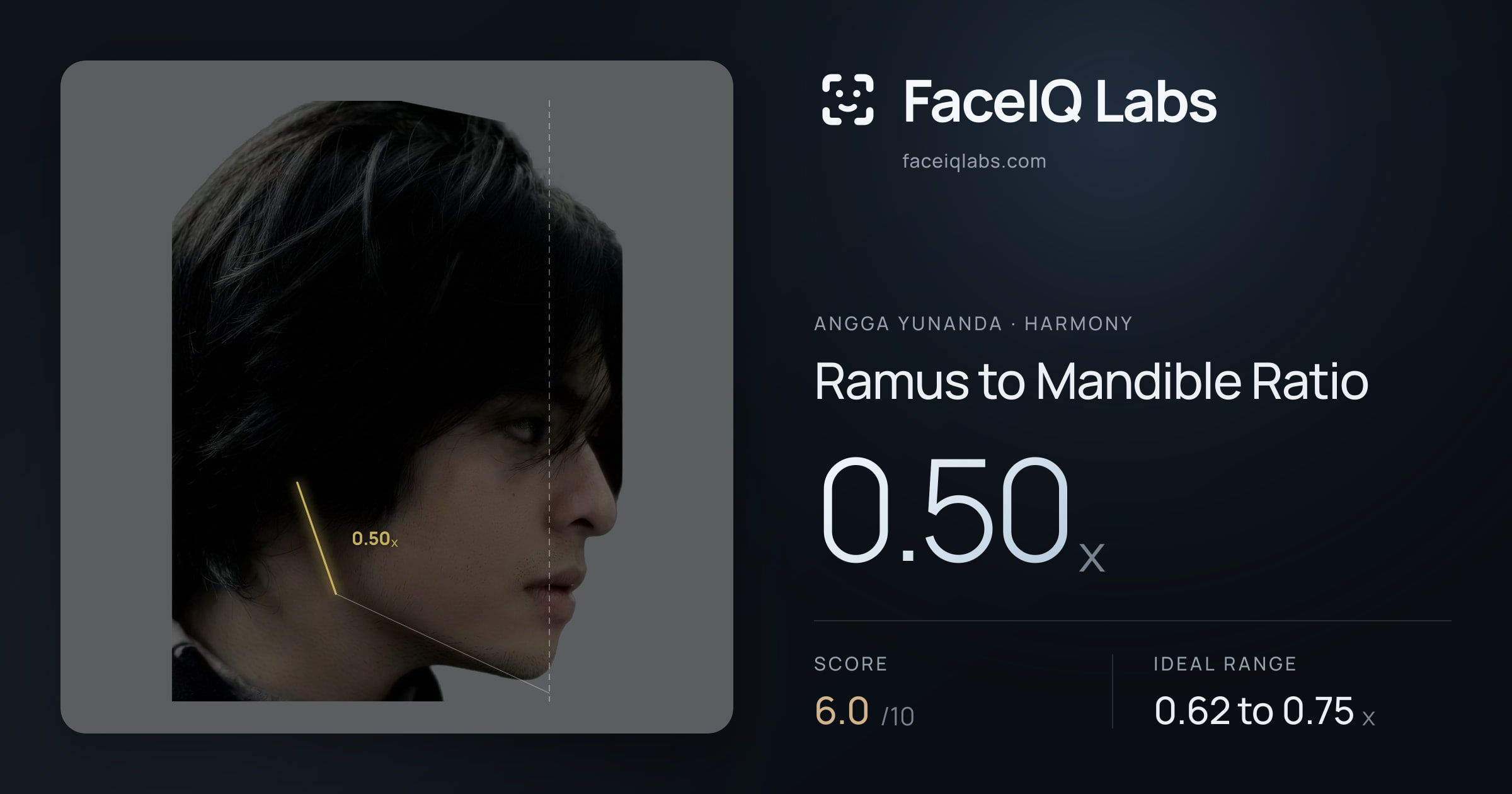 Angga Yunanda Ramus to Mandible Ratio: 0.50x, drawn on the photo