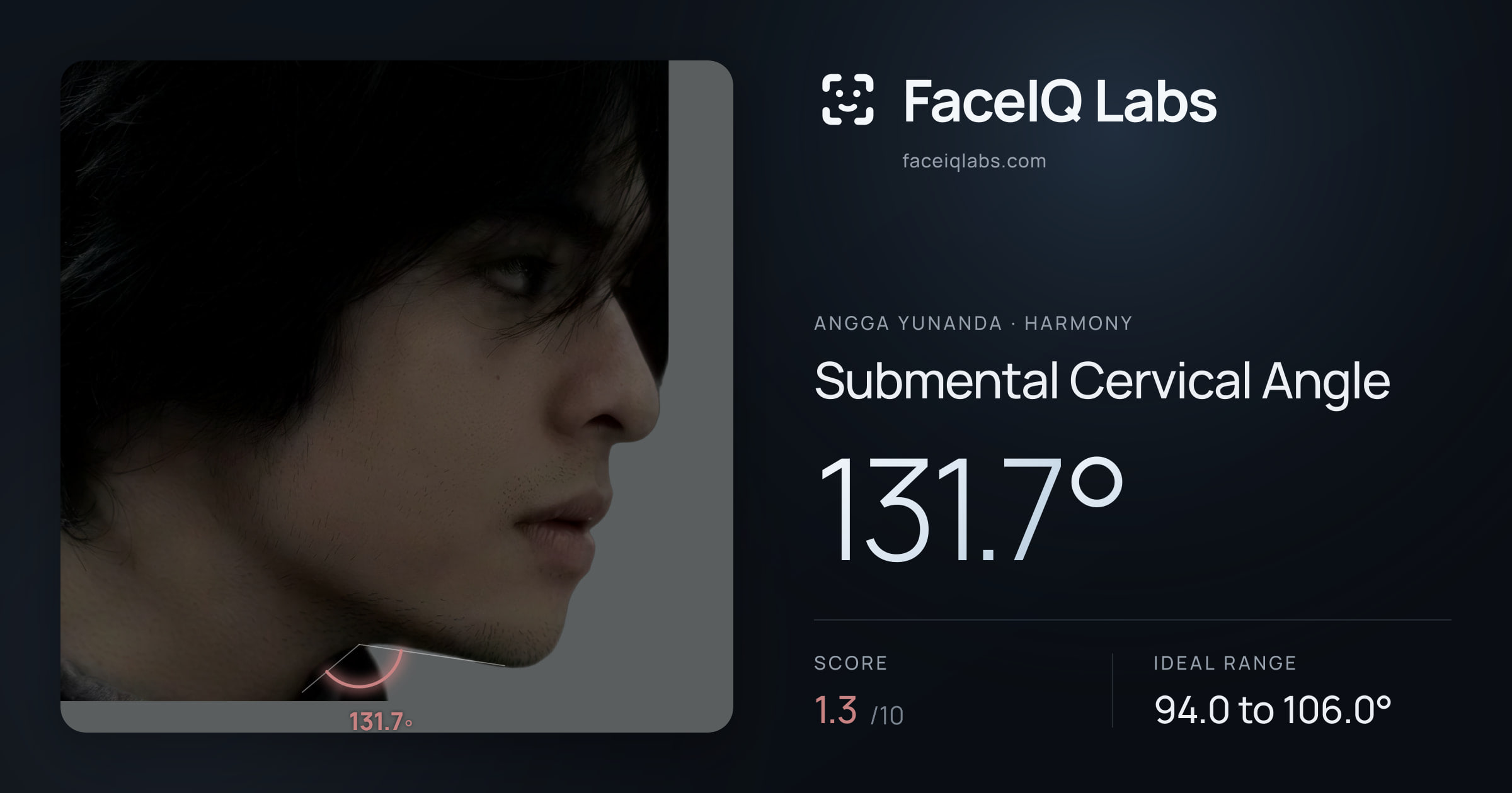 Angga Yunanda Submental Cervical Angle: 131.7°, drawn on the photo