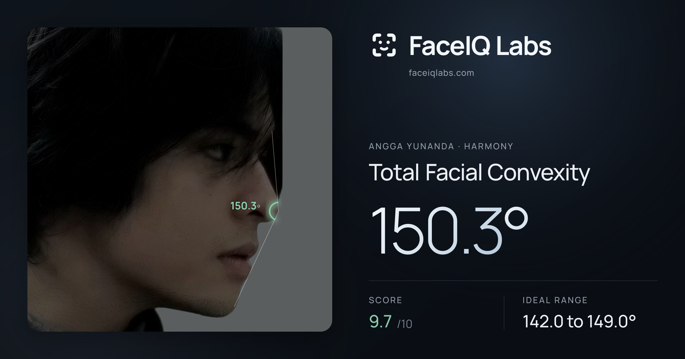 Angga Yunanda Total Facial Convexity: 150.3°, drawn on the photo