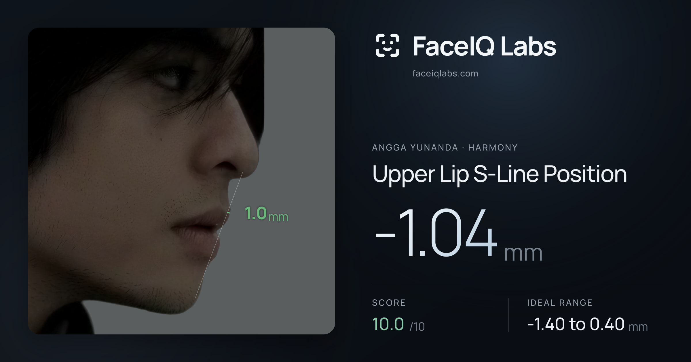 Angga Yunanda Upper Lip S-Line Position: -1.04mm, drawn on the photo