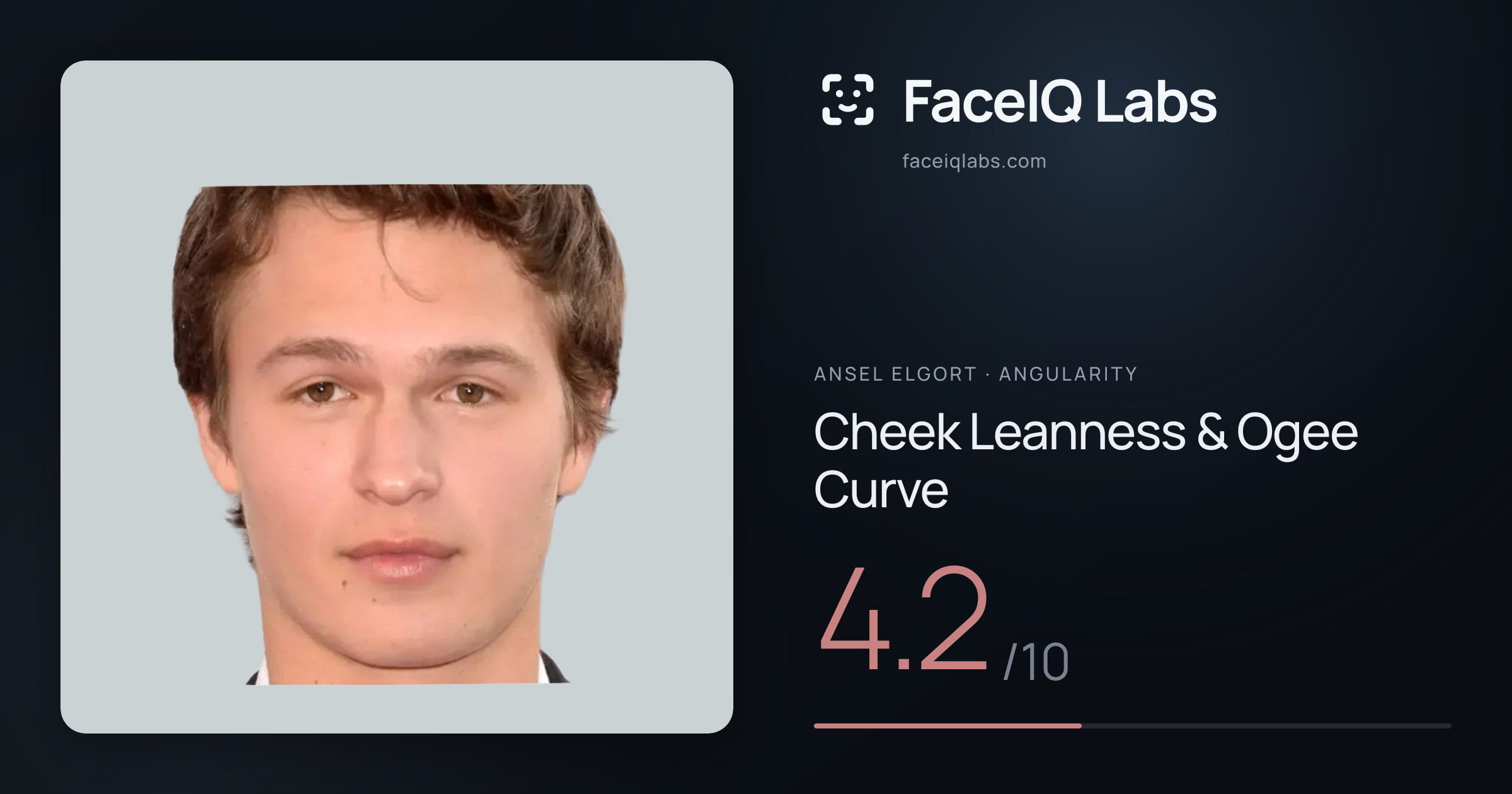 Ansel Elgort Cheek Leanness & Ogee Curve: 4.2/10, drawn on the photo