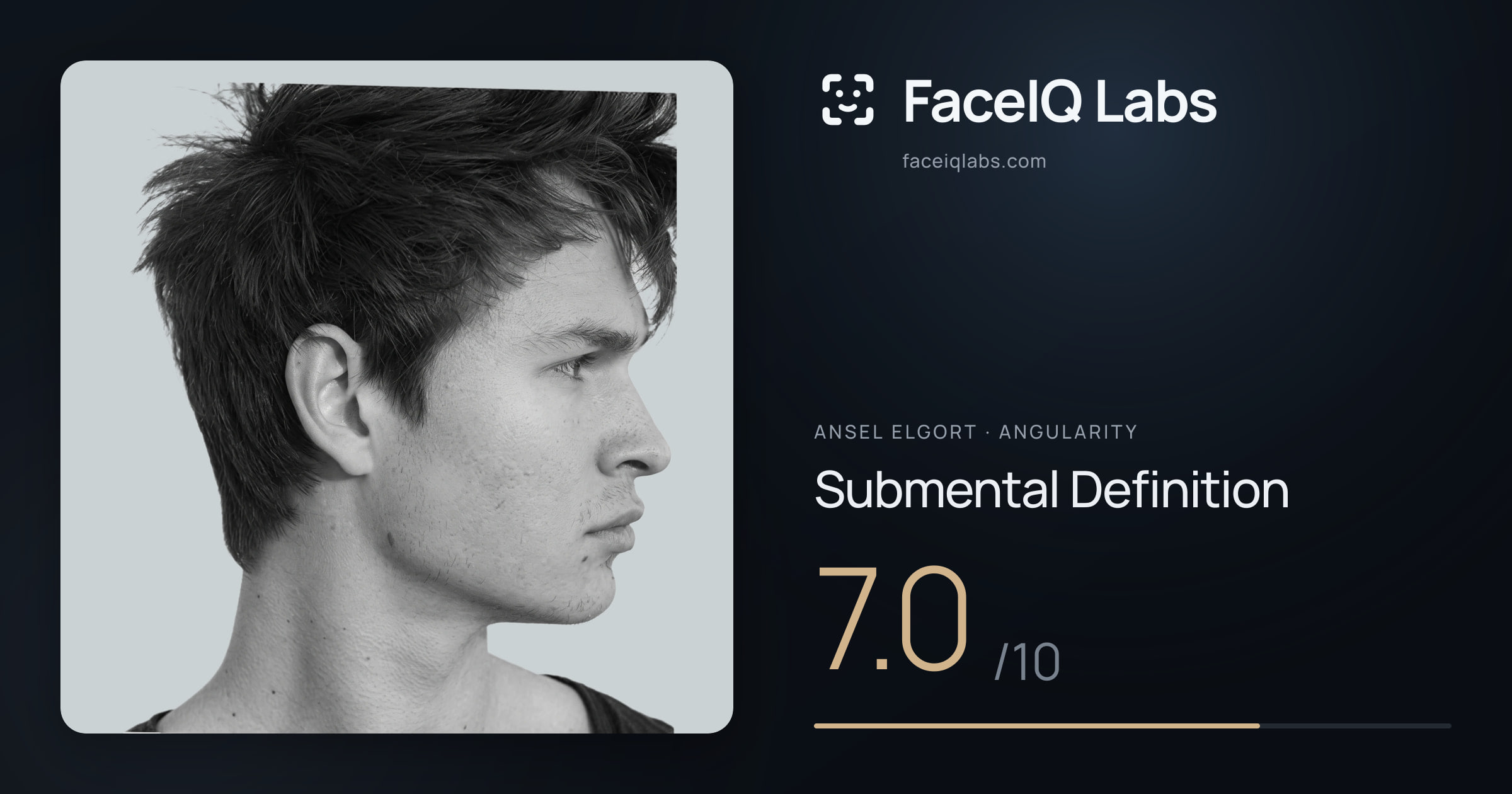 Ansel Elgort Submental Definition: 7.0/10, drawn on the photo