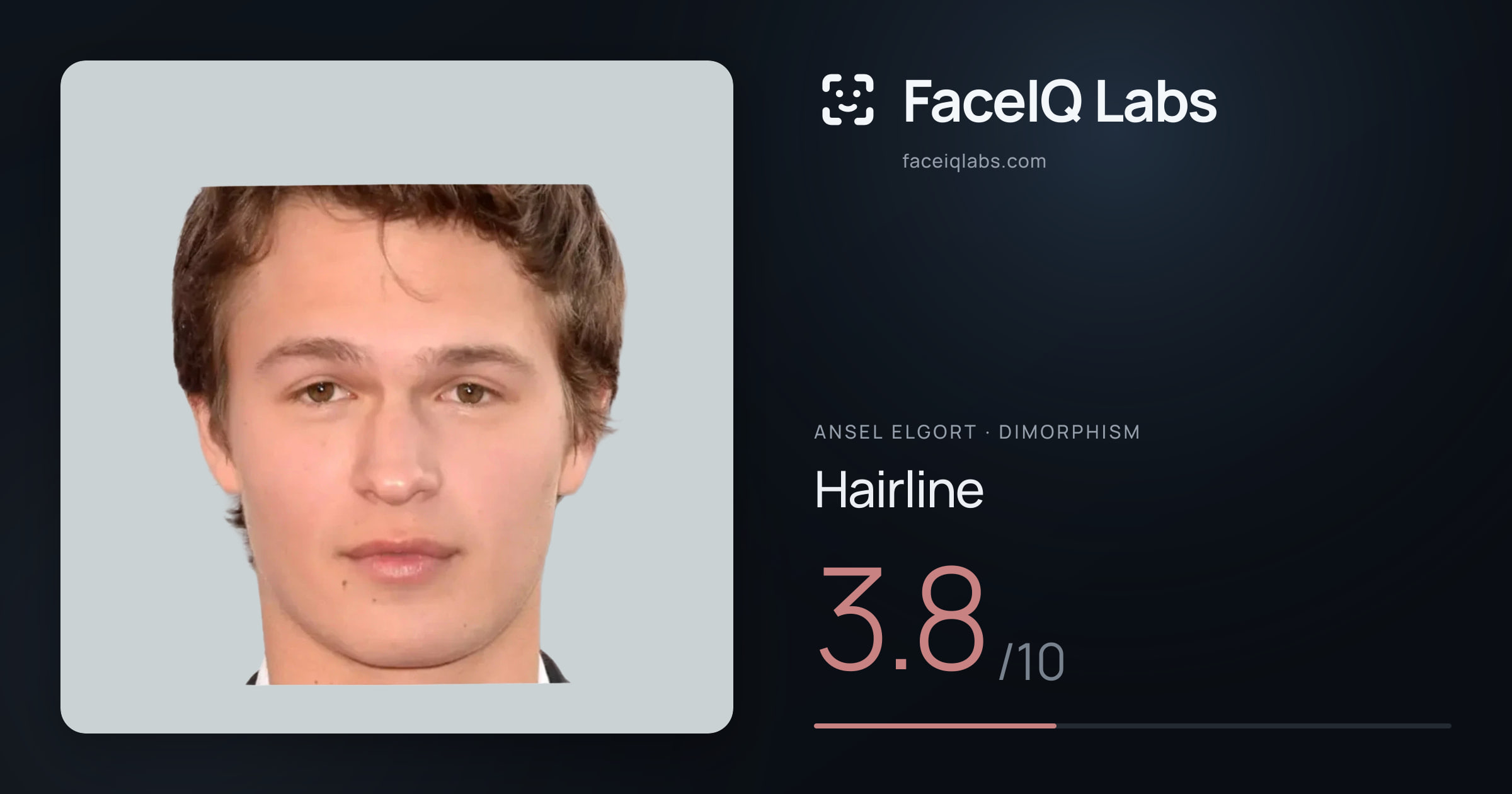 Ansel Elgort Hairline: 3.8/10, drawn on the photo