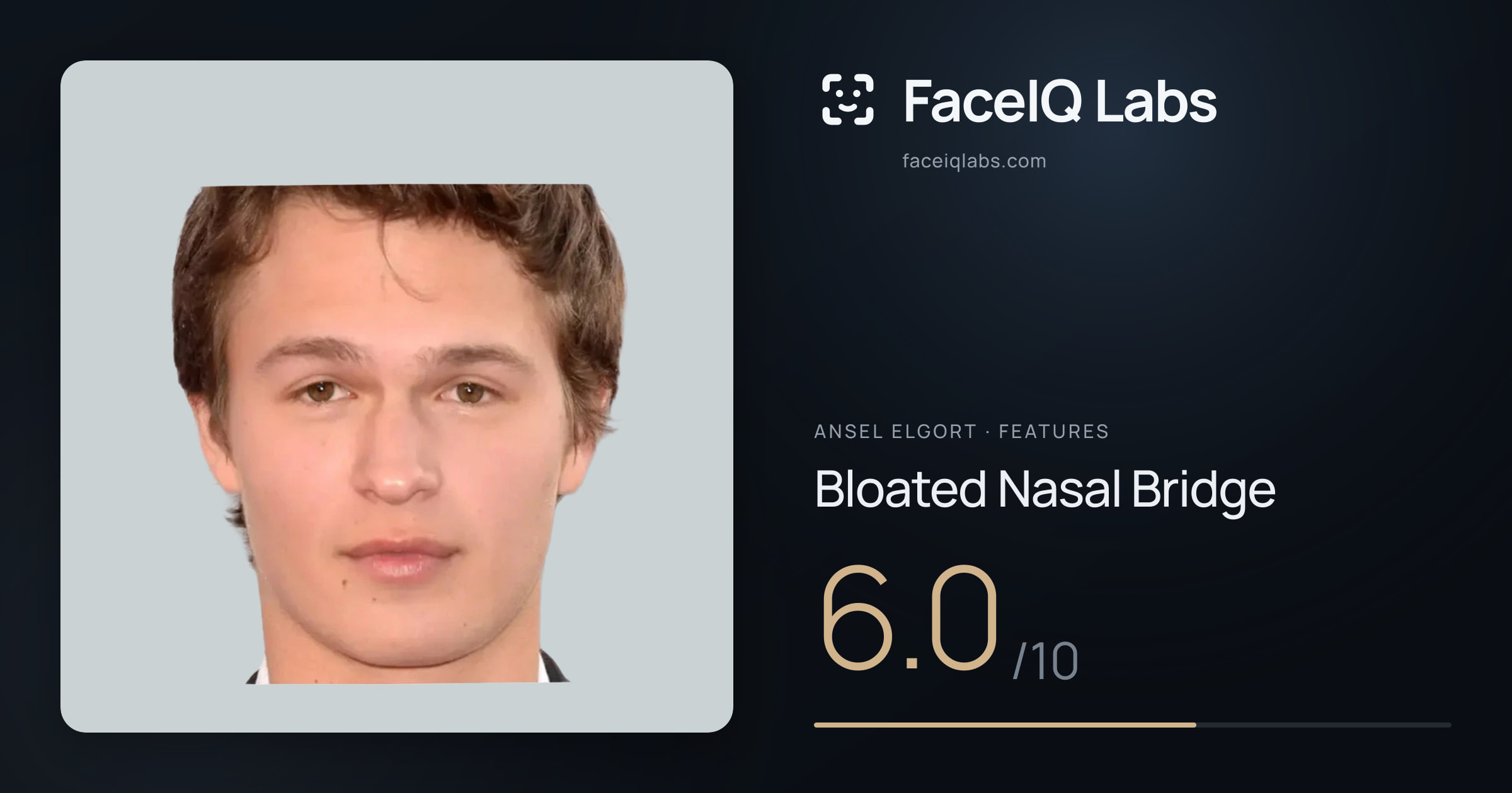 Ansel Elgort Bloated Nasal Bridge: 6.0/10, drawn on the photo