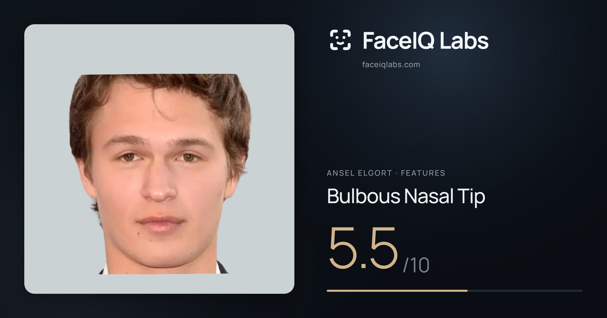 Ansel Elgort Bulbous Nasal Tip: 5.5/10, drawn on the photo